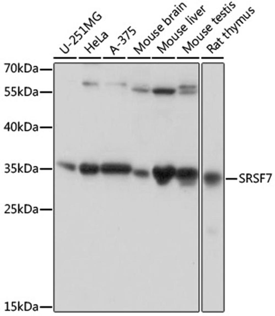 Western blot - SRSF7 antibody (A16738)