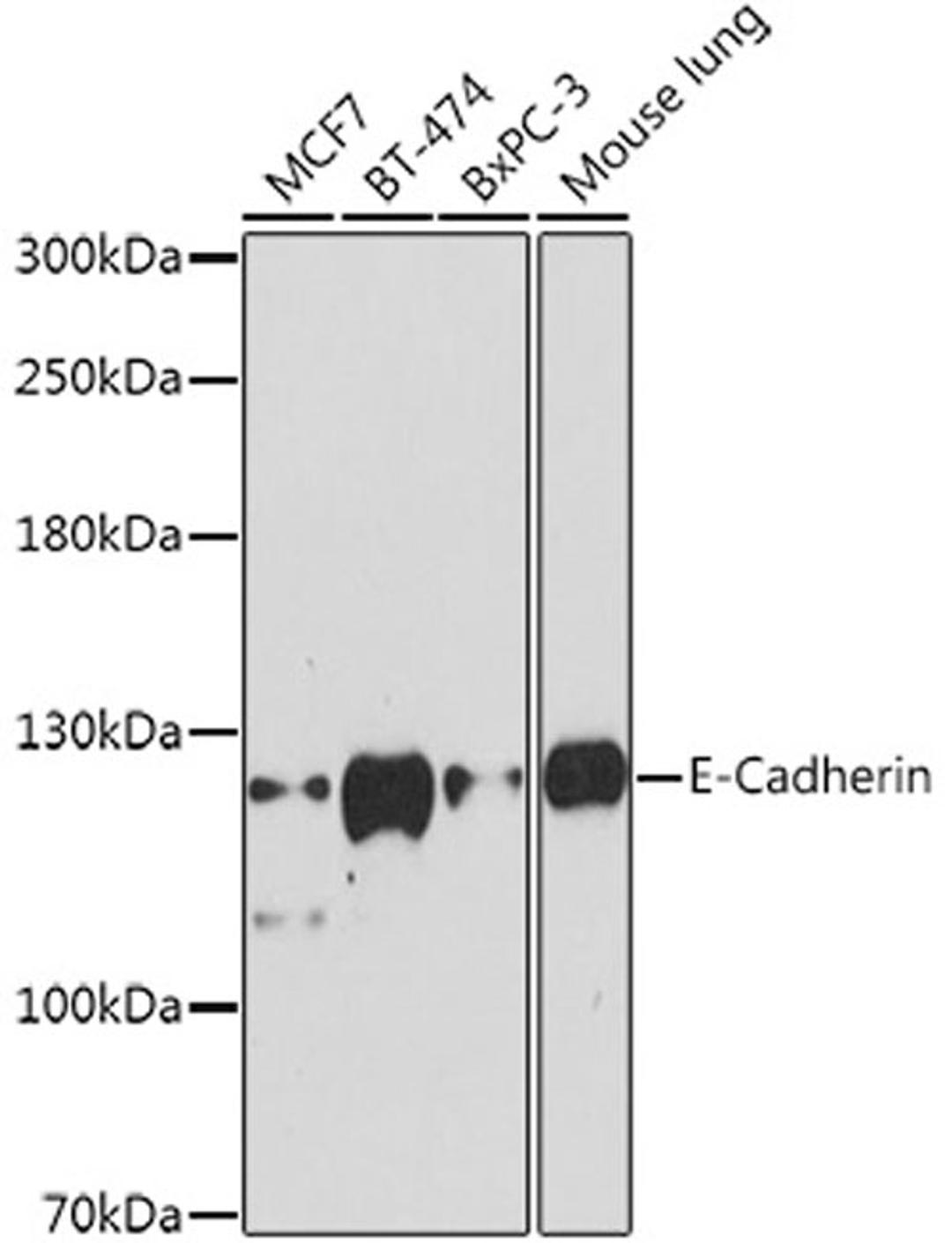 Western blot - E-Cadherin antibody (A11492)