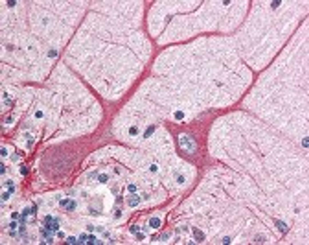 Immunohistochemistry staining of NOTCH1 in cerebellum tissue using NOTCH1 Antibody.