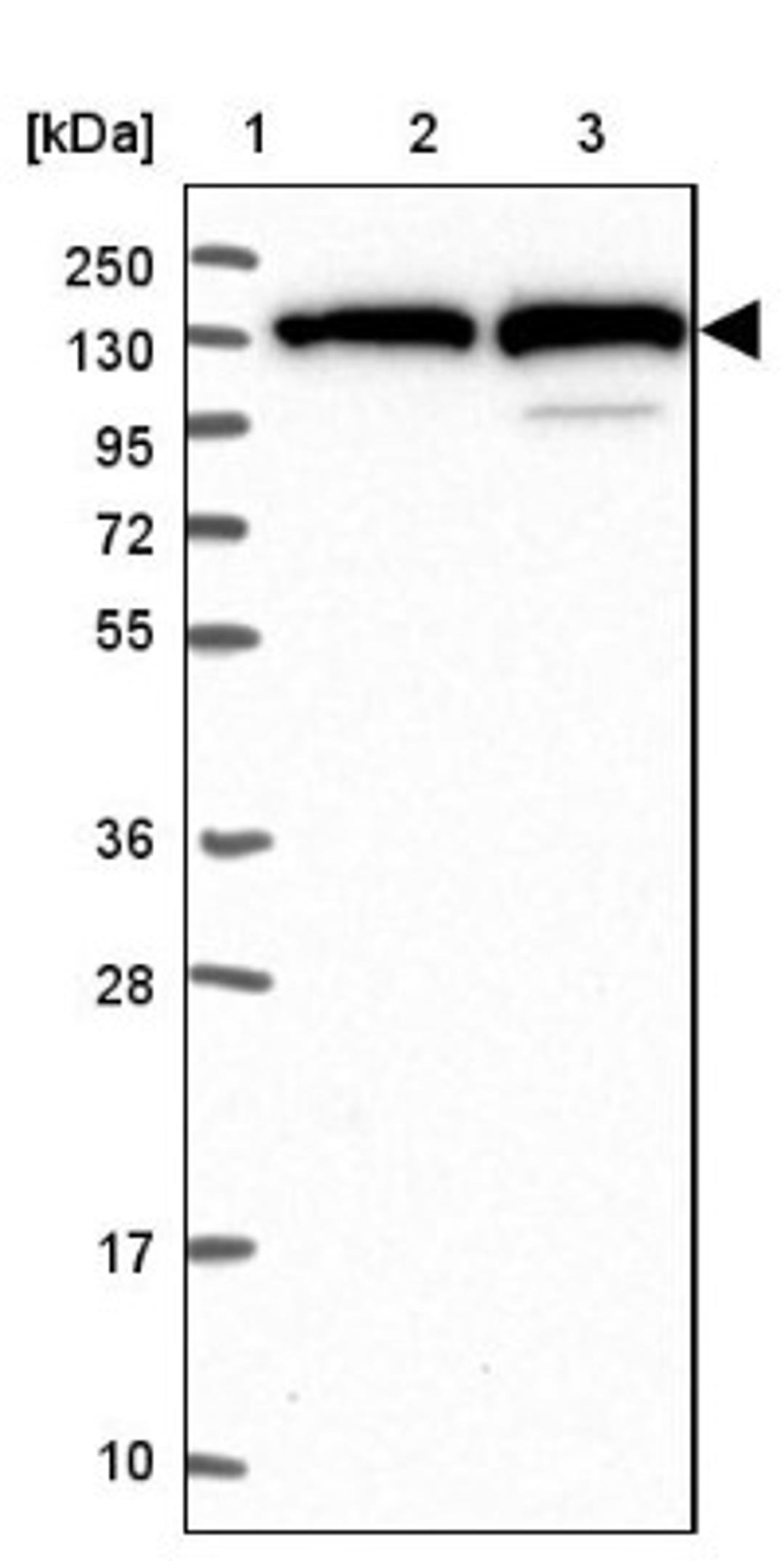 Western Blot: LARS Antibody [NBP2-38478] - Lane 1: Marker [kDa] 250, 130, 95, 72, 55, 36, 28, 17, 10<br/>Lane 2: RT-4<br/>Lane 3: U-251 MG