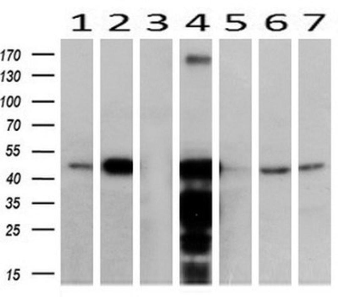 Western Blot: ACAA2 Antibody (1C10) [NBP2-46477] - Analysis of extracts (10ug) from 7 Human tissues ( 1: Uterus; 2: Breast; 3: Brain; 4: Liver; 5: Ovary; 6: Thyroid gland; 7: colon)