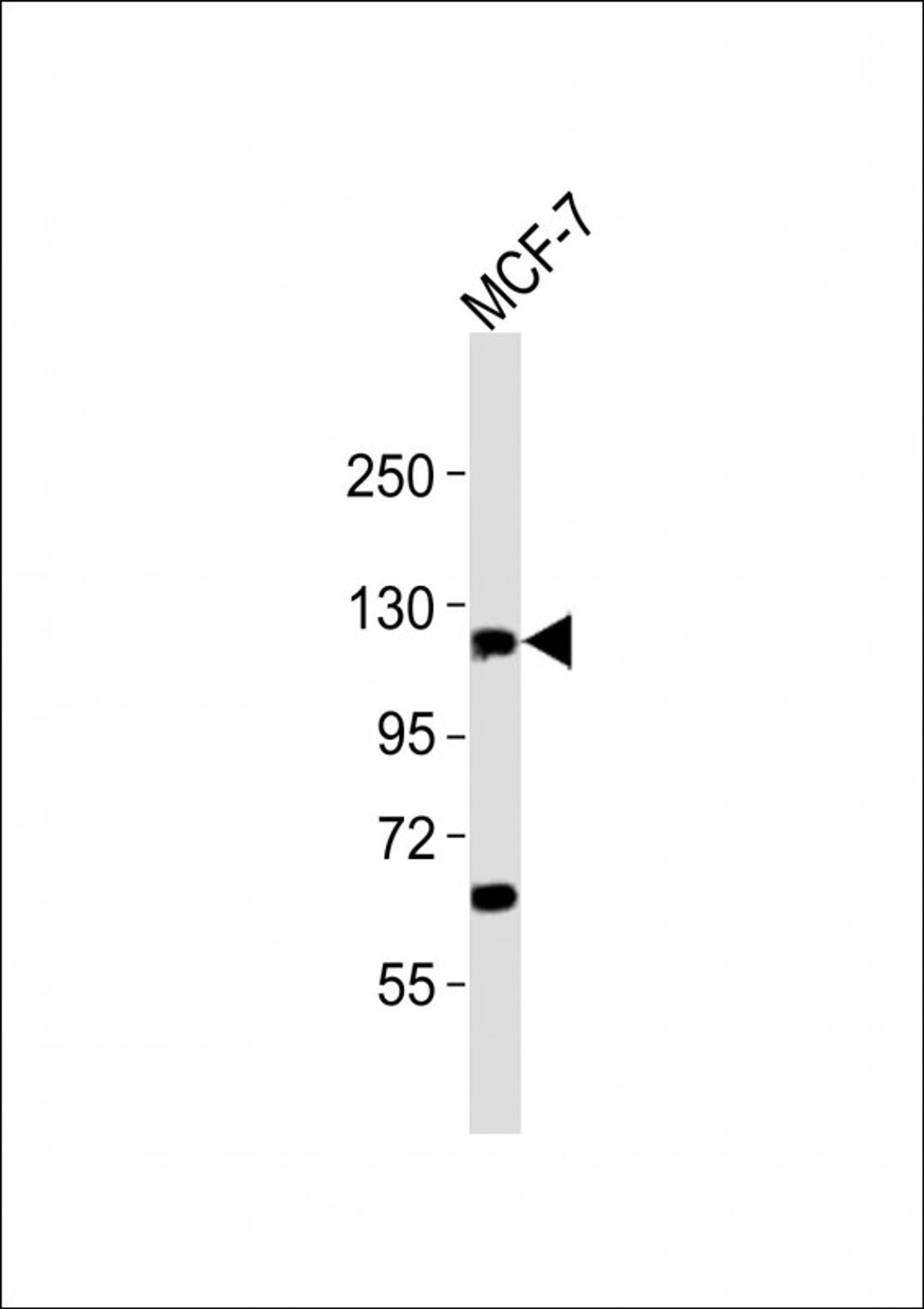 Western Blot at 1:2000 dilution + MCF-7 whole cell lysates Lysates/proteins at 20 ug per lane.