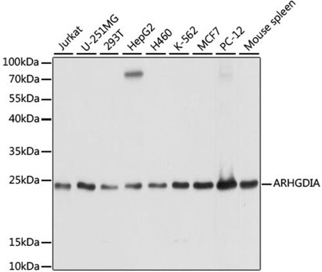 Western blot - ARHGDIA antibody (A13468)