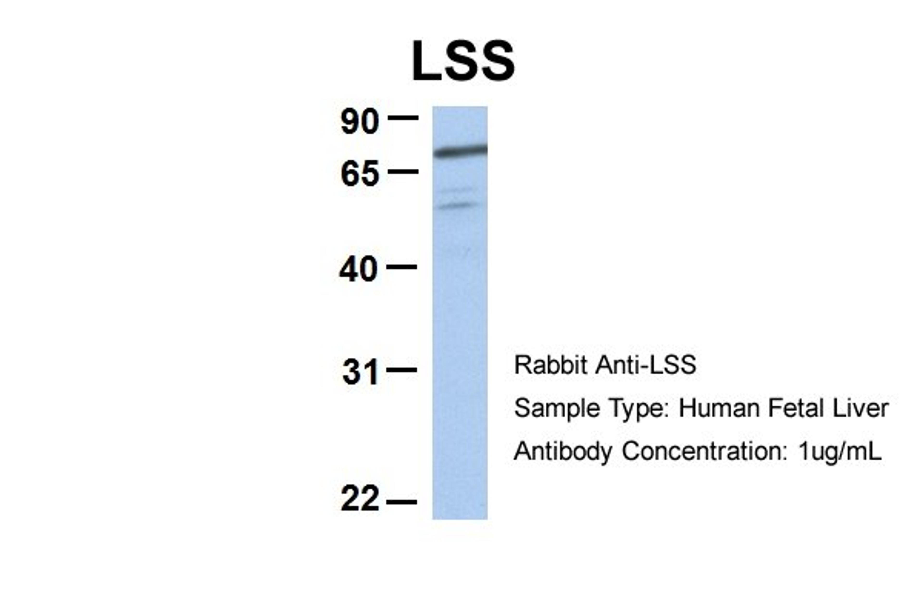 Antibody used in WB on Hum. Fetal Heart at 1 ug/ml.