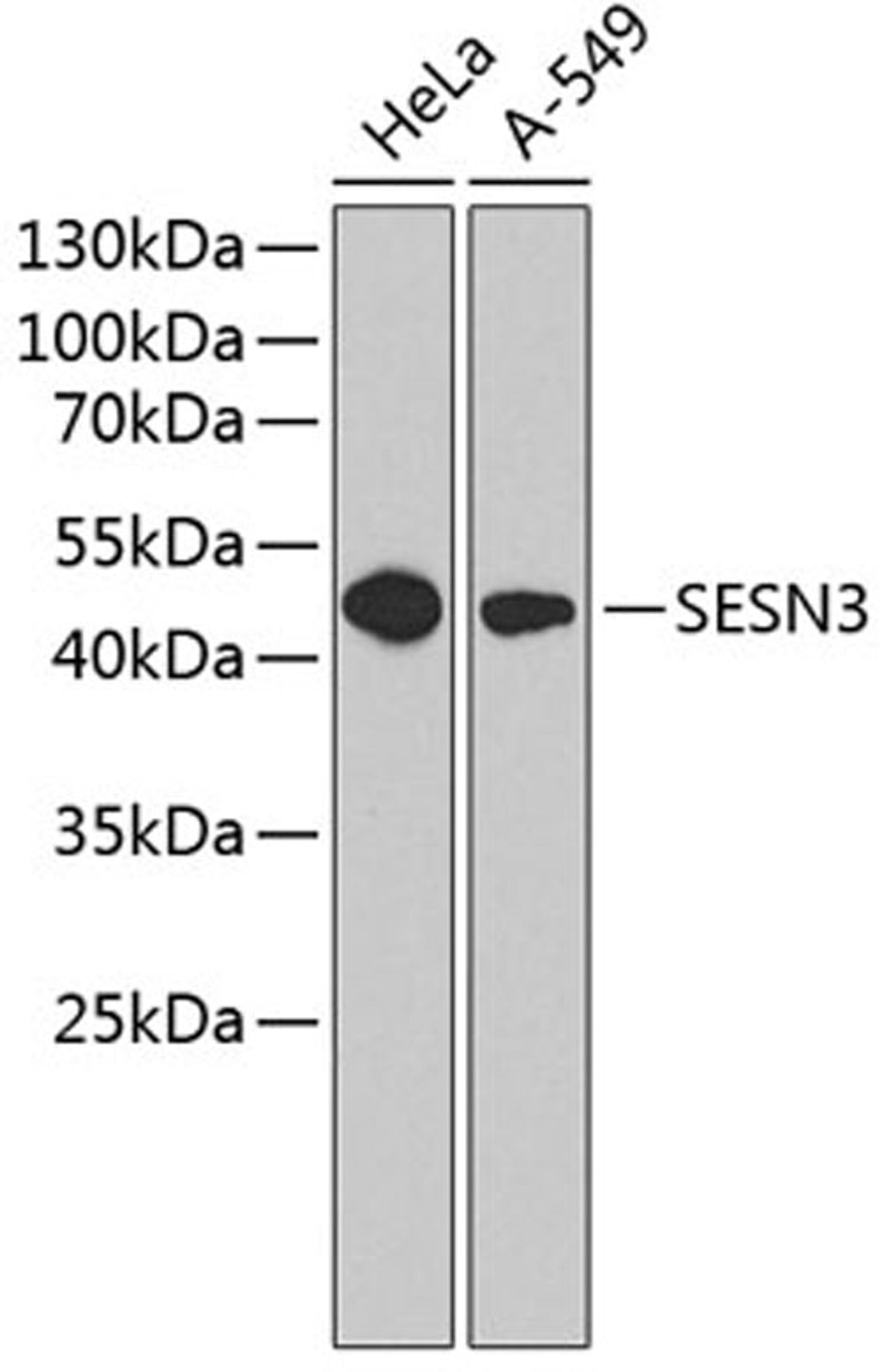 Western blot - SESN3 antibody (A5164)