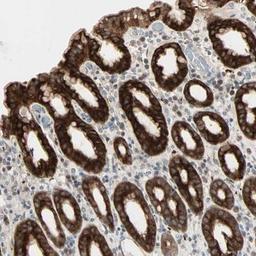 Immunohistochemistry: Lactase Antibody [NBP1-87586] - Staining of human stomach shows strong cytoplasmic positivity in glandular cells.