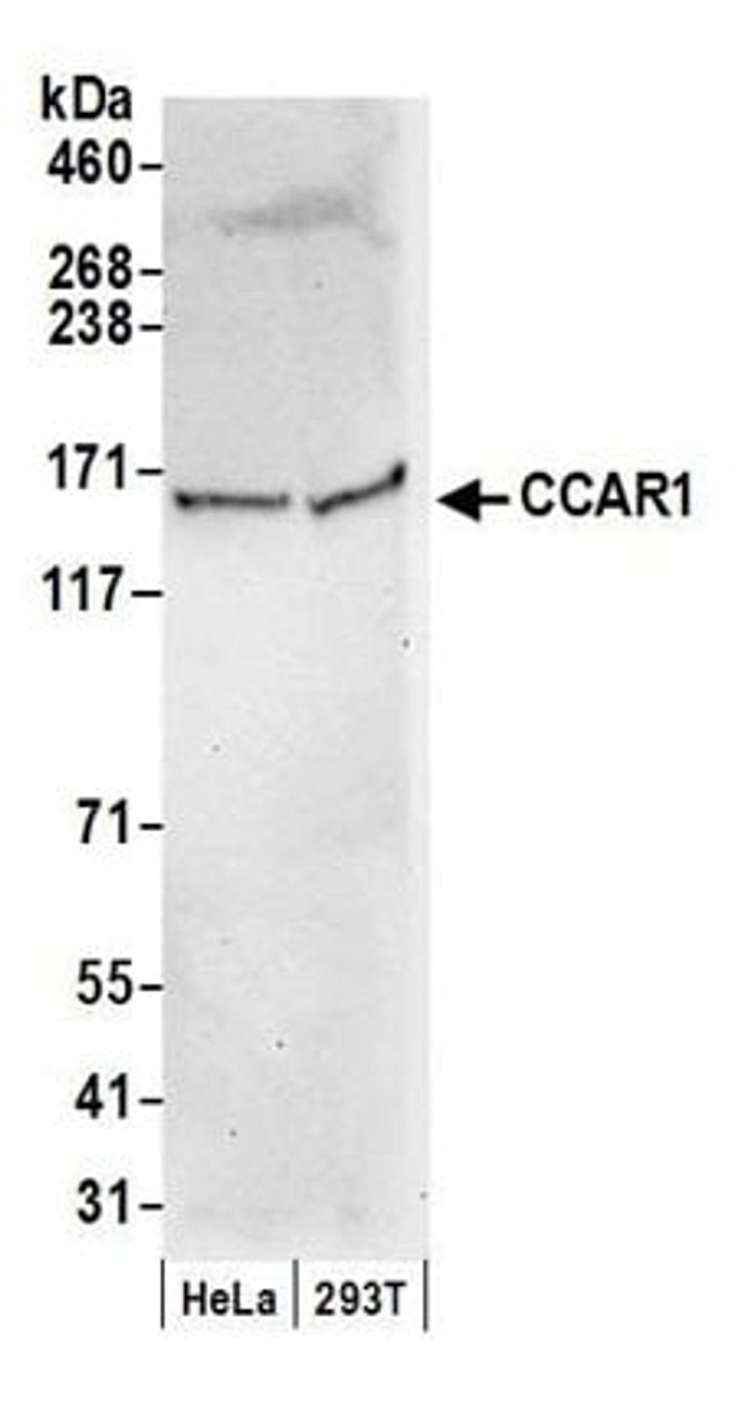 Detection of human CCAR1 by western blot.