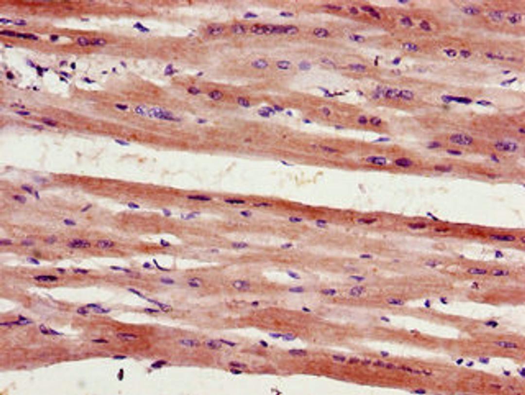 Immunohistochemistry of paraffin-embedded human heart tissue using CSB-PA617906LA01HU at dilution of 1:100