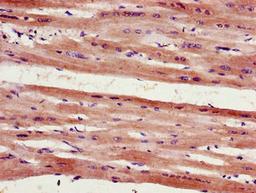 Immunohistochemistry of paraffin-embedded human heart tissue using CSB-PA617906LA01HU at dilution of 1:100
