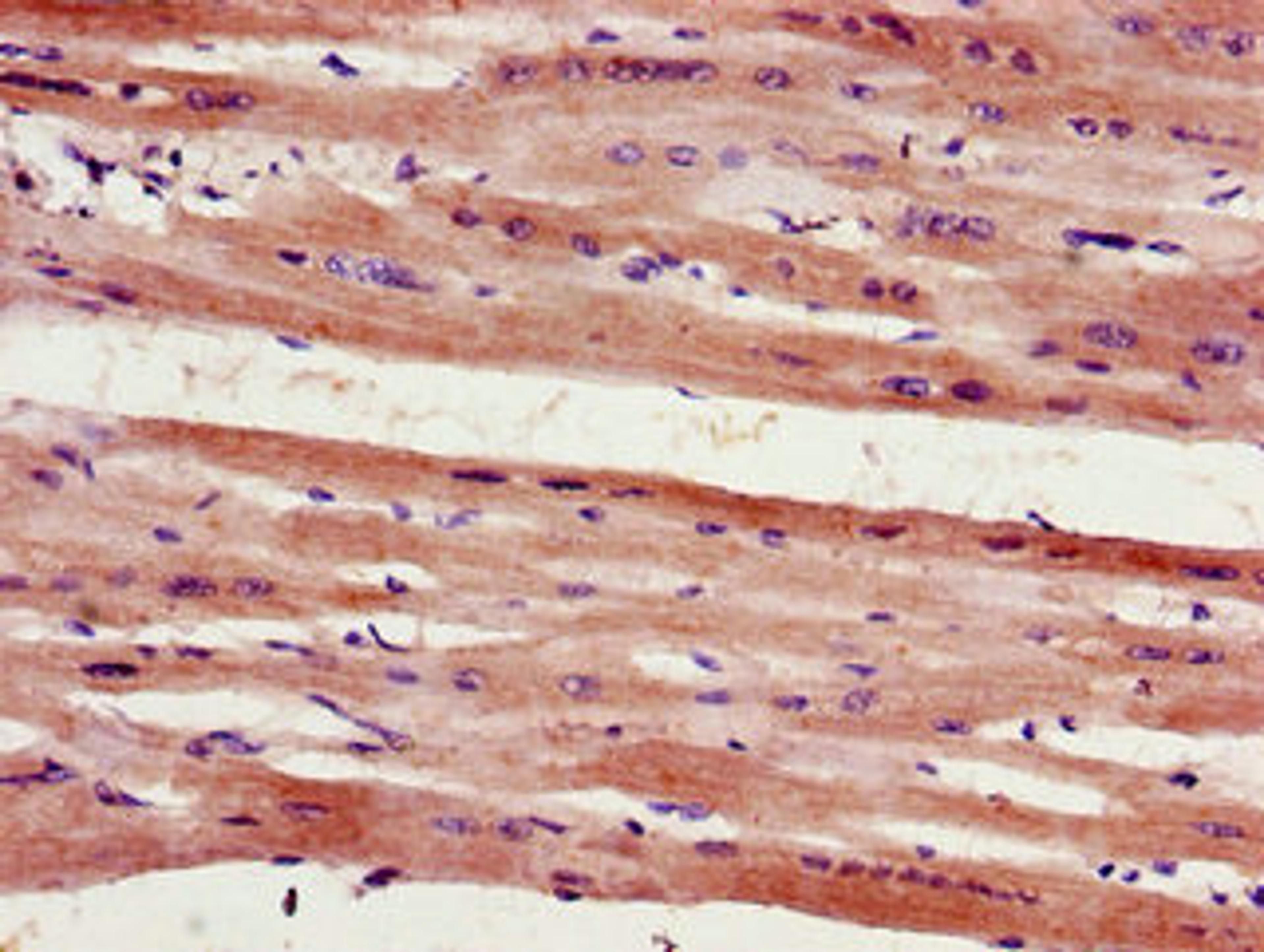 Immunohistochemistry of paraffin-embedded human heart tissue using CSB-PA617906LA01HU at dilution of 1:100
