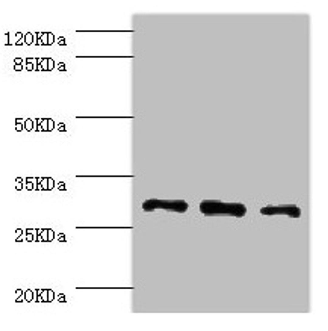 Western blot. All lanes: NNMT antibody at 2.47µg/ml. Lane 1: HepG2 whole cell lysate. Lane 2: Hela whole cell lysate. Lane 3: A549 whole cell lysate. Secondary. Goat polyclonal to rabbit IgG at 1/10000 dilution. Predicted band size: 30 kDa. Observed band size: 30 kDa