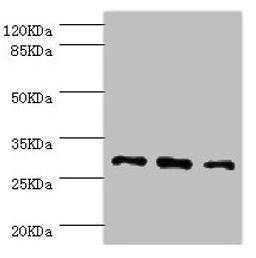 Western blot. All lanes: NNMT antibody at 2.47µg/ml. Lane 1: HepG2 whole cell lysate. Lane 2: Hela whole cell lysate. Lane 3: A549 whole cell lysate. Secondary. Goat polyclonal to rabbit IgG at 1/10000 dilution. Predicted band size: 30 kDa. Observed band size: 30 kDa
