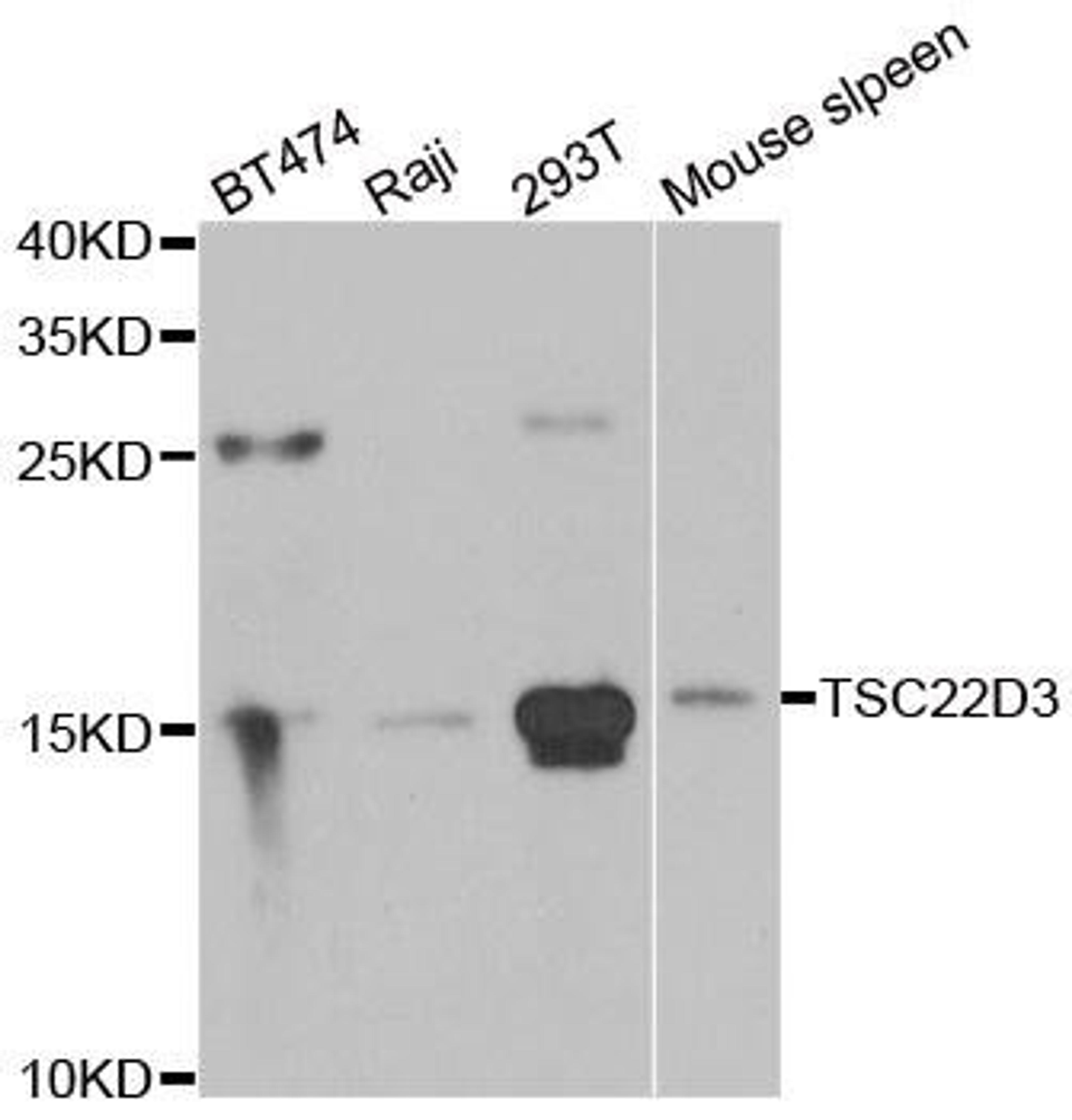 Western blot analysis of extracts of various cell lines using TSC22D3 antibody