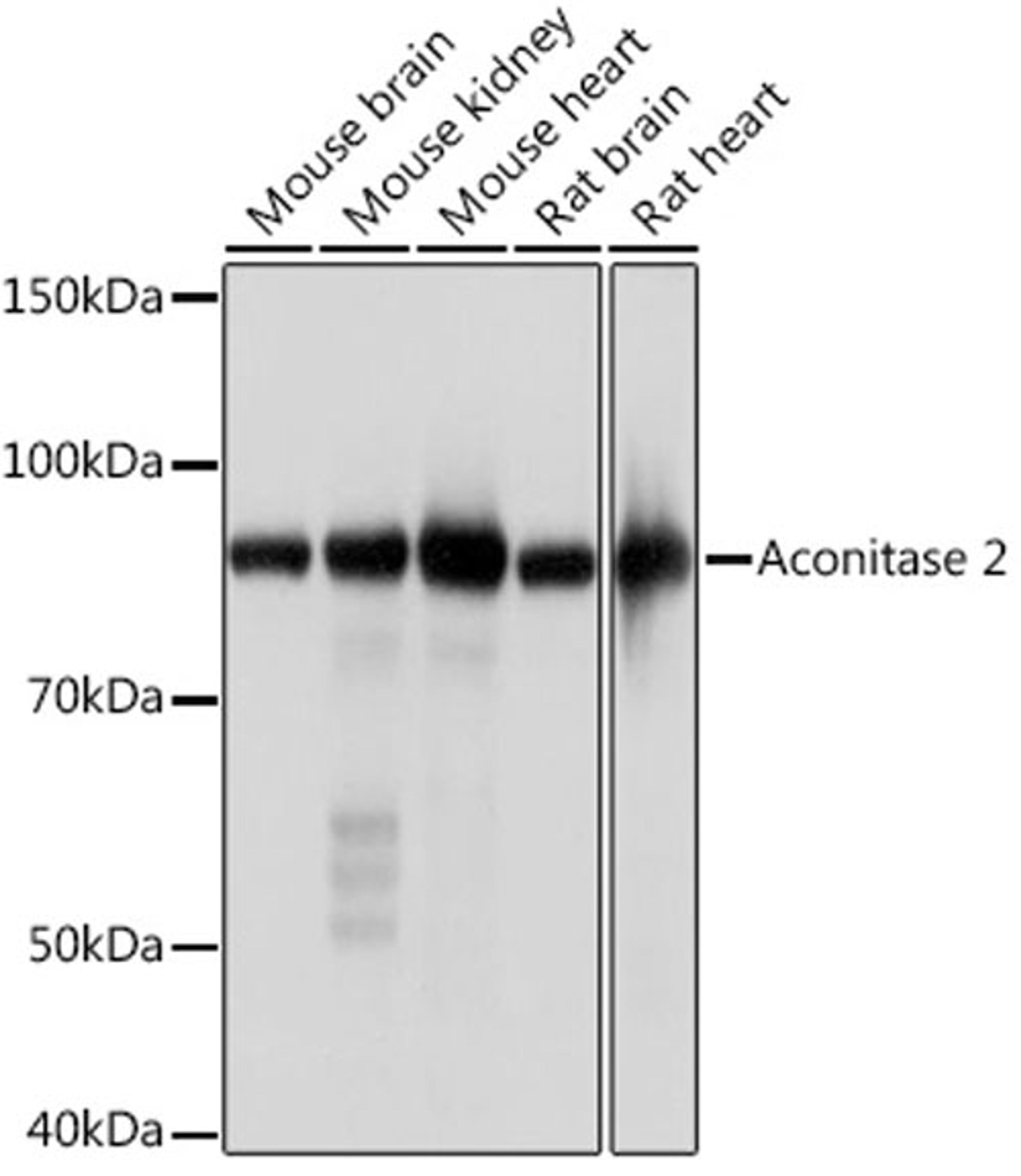 Western blot - Aconitase 2 Rabbit mAb (A4524)