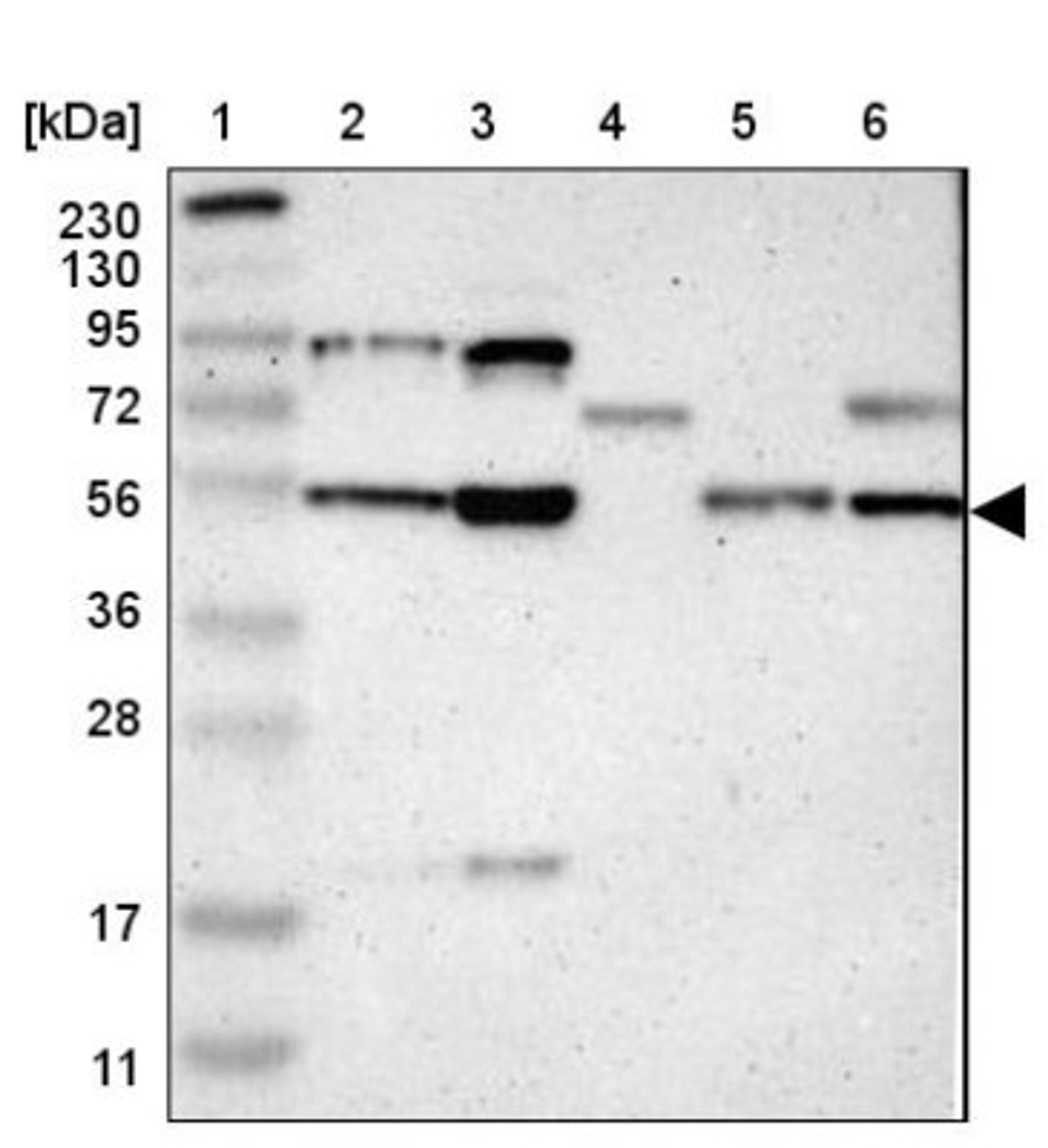 Western Blot: Nucleobindin 2 Antibody [NBP1-87383] - Lane 1: Marker [kDa] 230, 130, 95, 72, 56, 36, 28, 17, 11<br/>Lane 2: Human cell line RT-4<br/>Lane 3: Human cell line U-251MG sp<br/>Lane 4: Human plasma (IgG/HSA depleted)<br/>Lane 5: Human liver tissue<br/>Lane 6: Human tonsil tissue