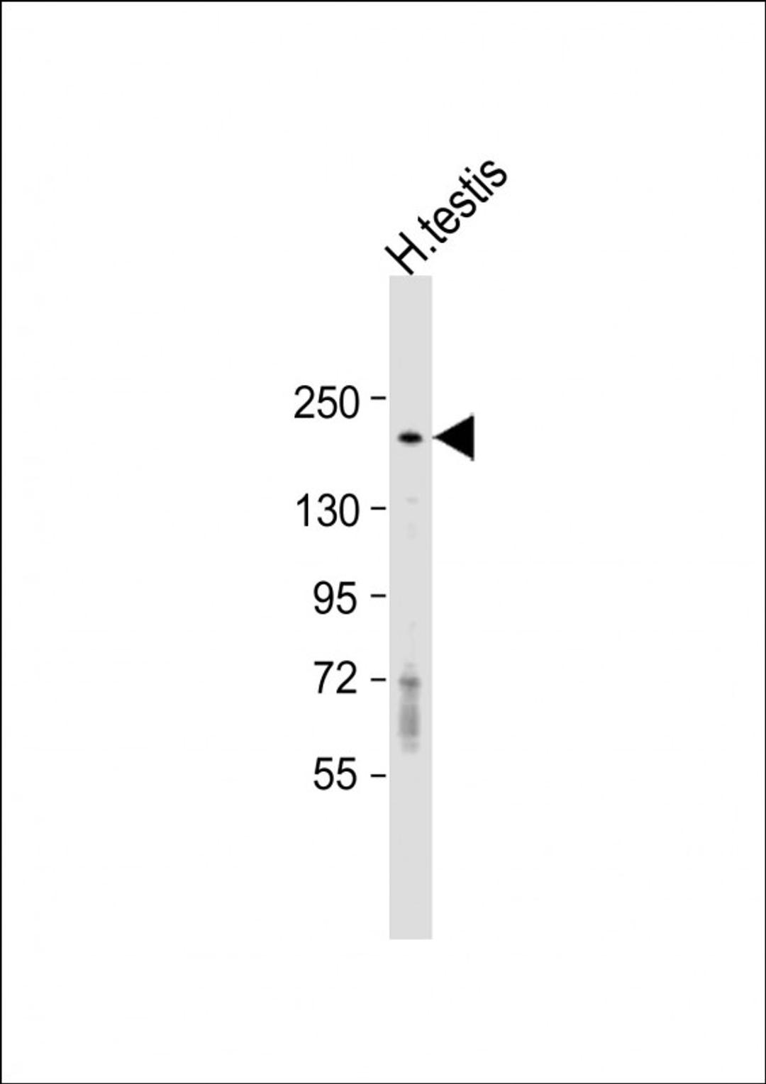 Western Blot at 1:1000 dilution + human testis lysate Lysates/proteins at 20 ug per lane.