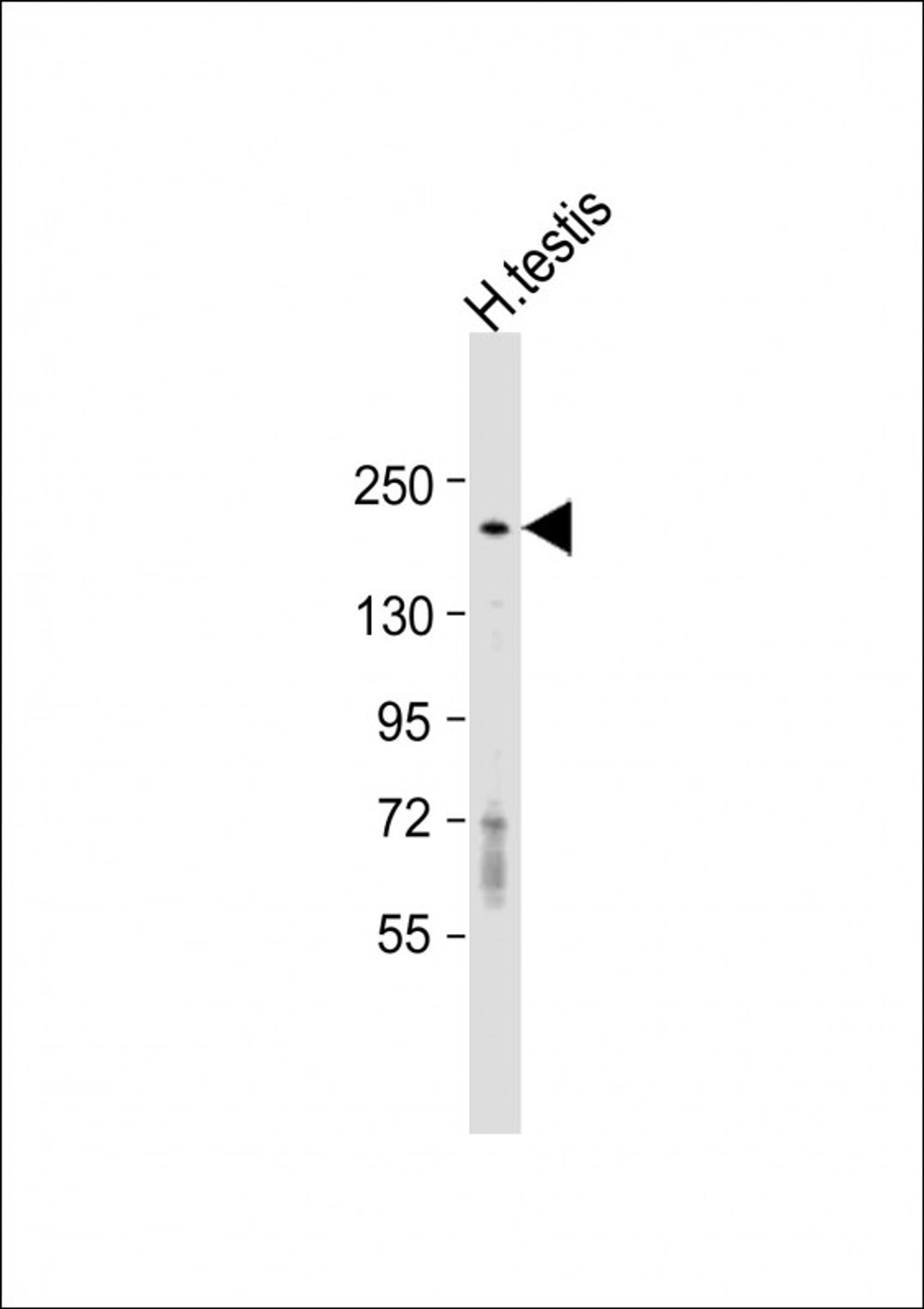 Western Blot at 1:1000 dilution + human testis lysate Lysates/proteins at 20 ug per lane.