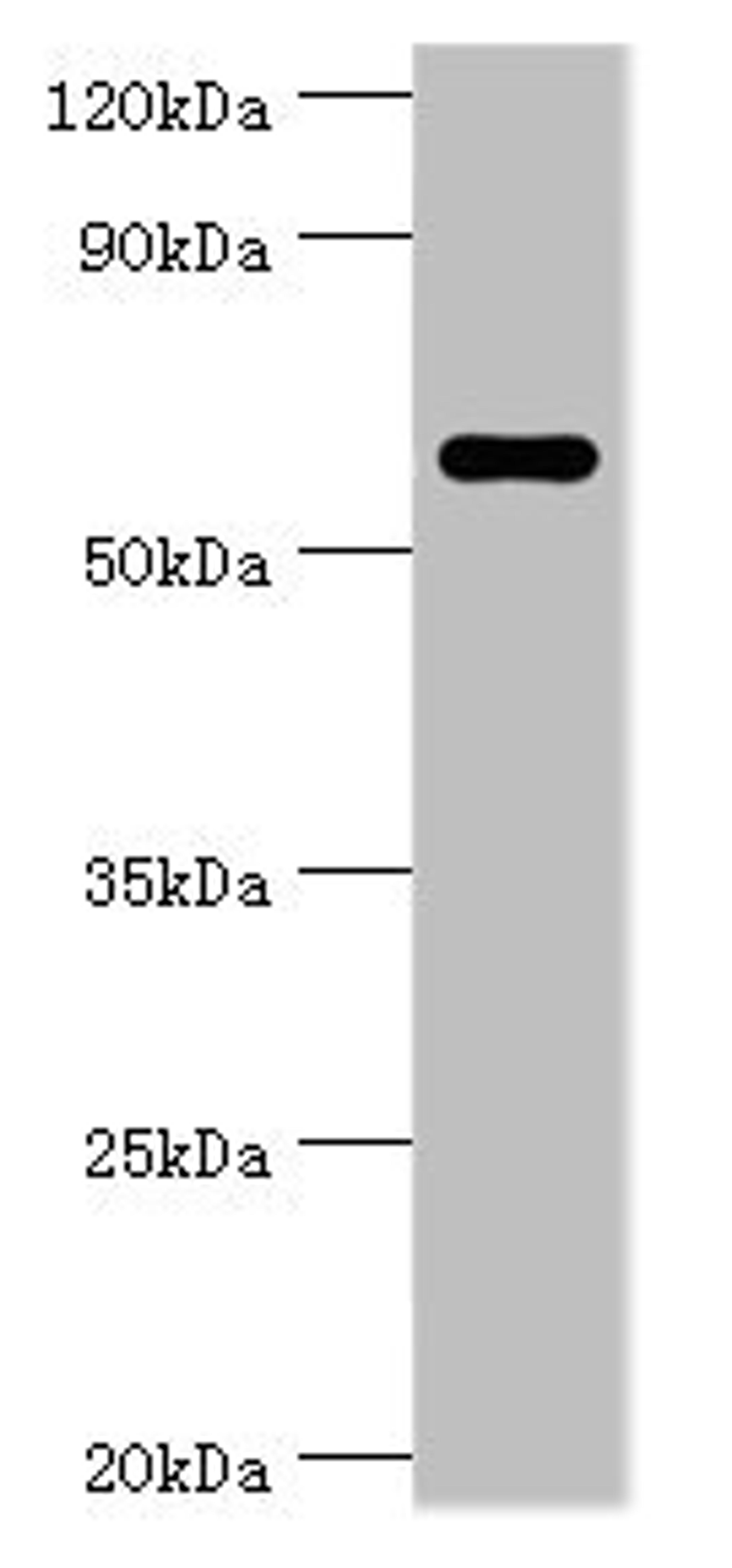 Western blot. All lanes: CSTF2 antibody at 6ug/ml + Jurkat whole cell lysate. Secondary. Goat polyclonal to rabbit IgG at 1/10000 dilution. Predicted band size: 61, 60 kDa. Observed band size: 61 kDa. 