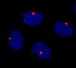 Detection of human CEP290 by immunocytochemistry.