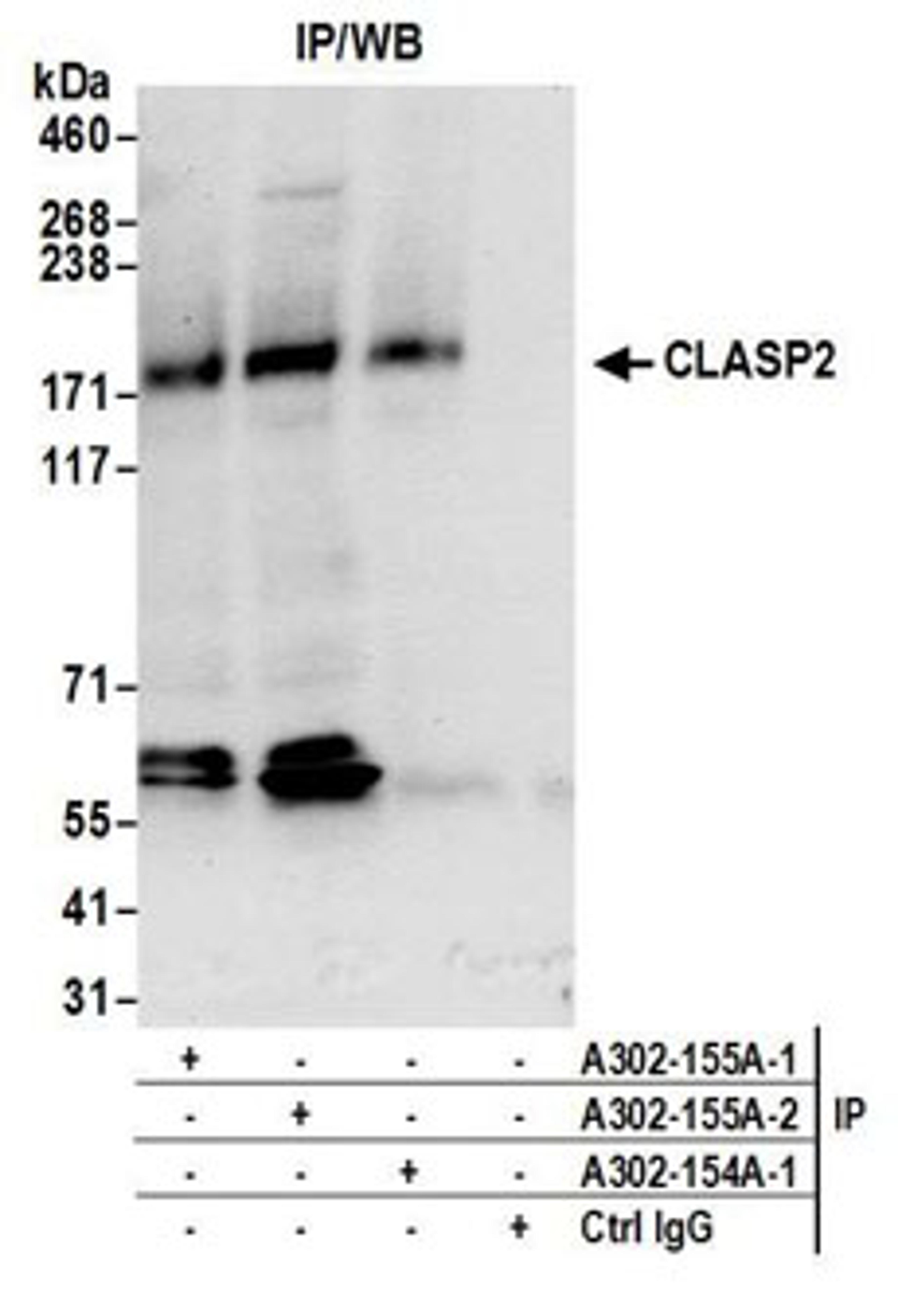 Detection of human CLASP2 by western blot of immunoprecipitates.