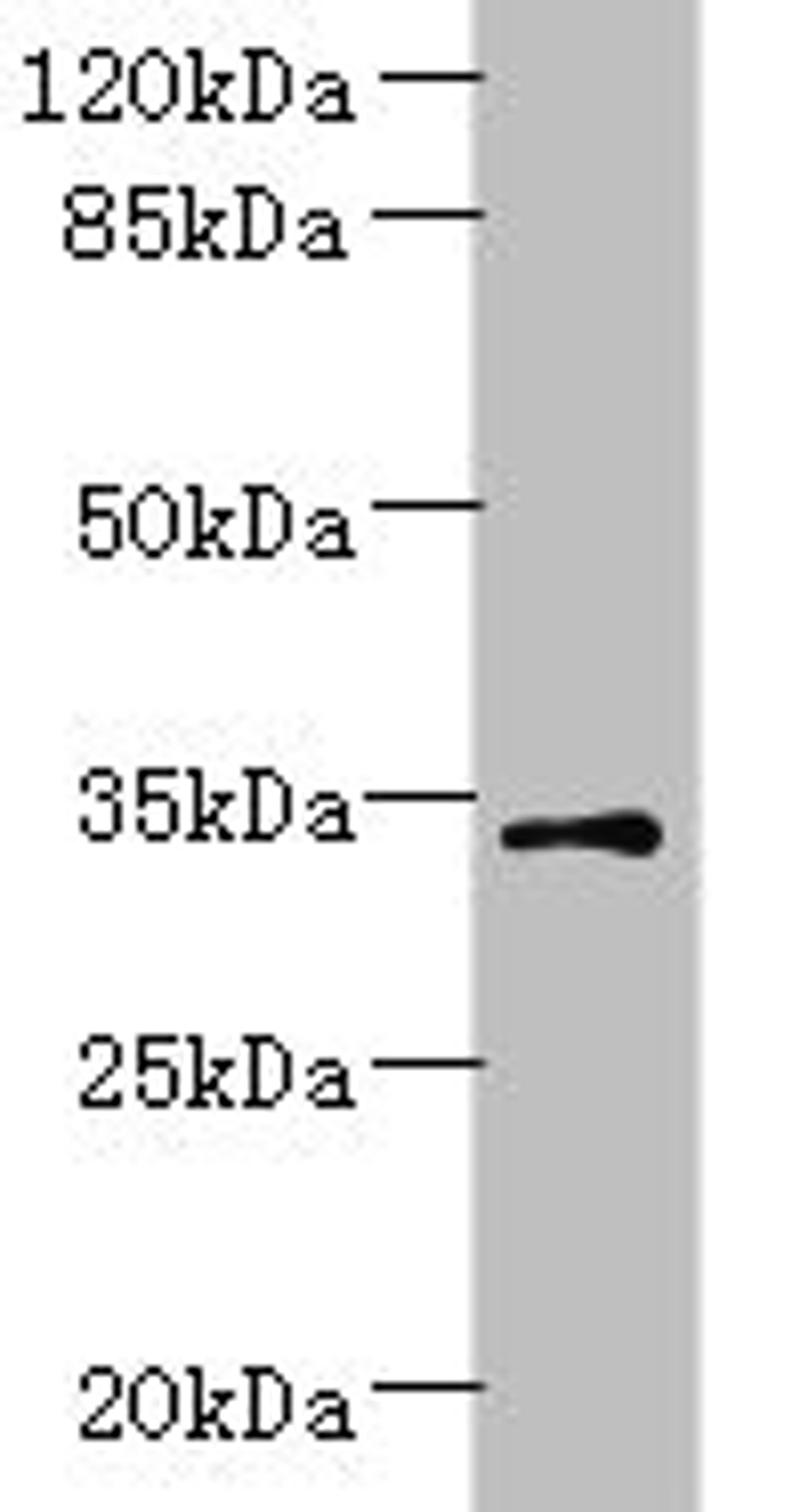 Western blot. All lanes: ZDHHC3 antibody at 1.5ug/ml + Mouse brain tissue. Secondary. Goat polyclonal to rabbit IgG at 1/10000 dilution. Predicted band size: 35, 38 kDa. Observed band size: 35 kDa.