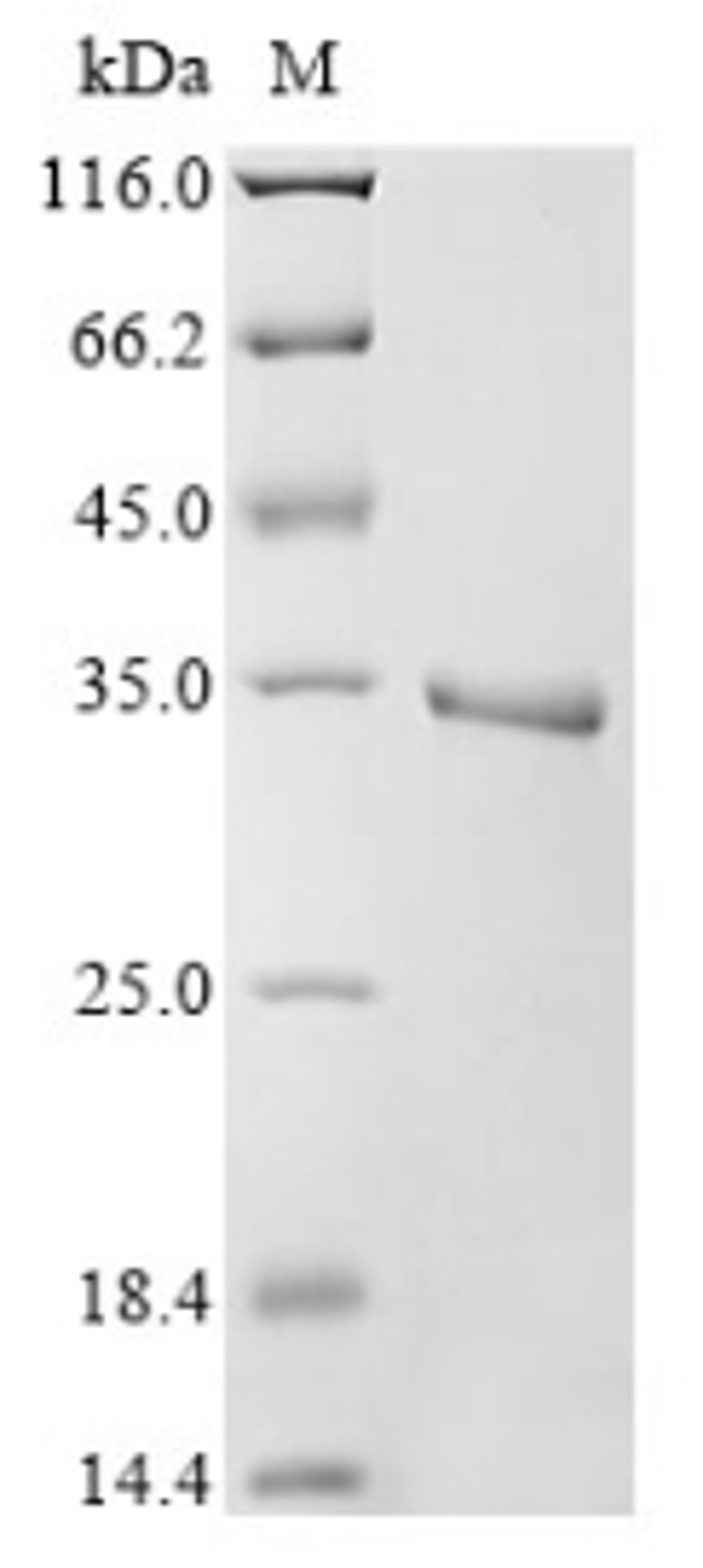 (Tris-Glycine gel) Discontinuous SDS-PAGE (reduced) with 5% enrichment gel and 15% separation gel.