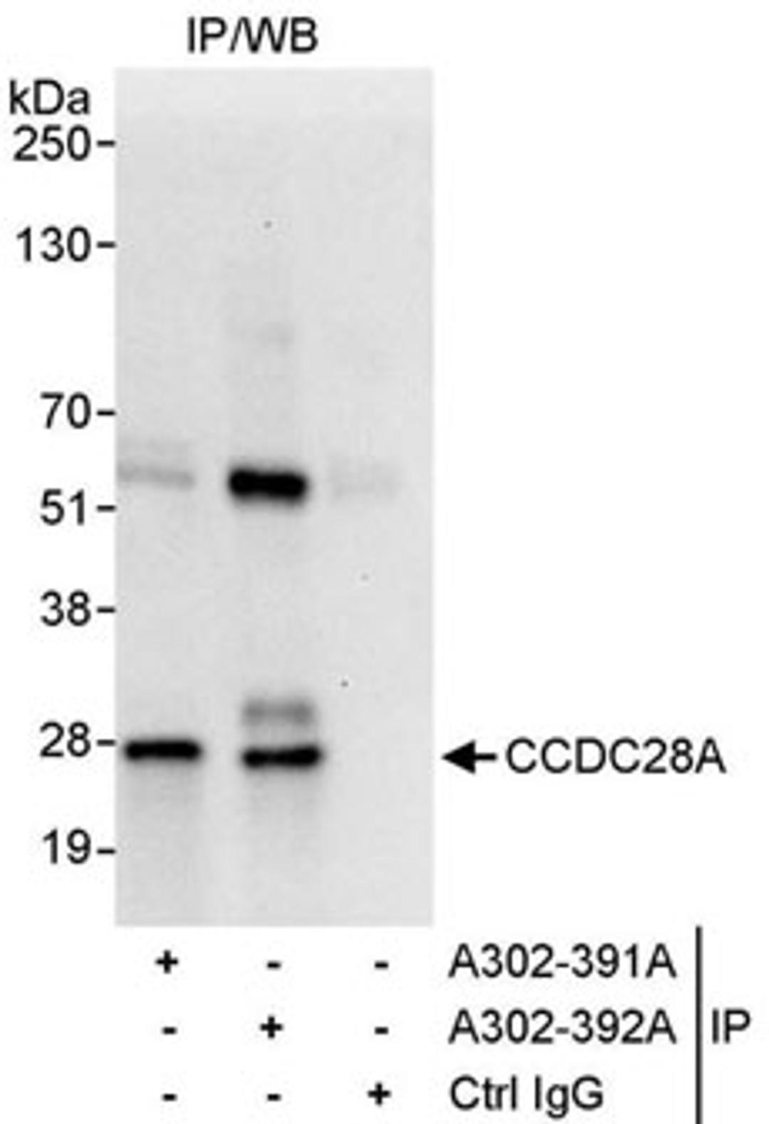 Detection of human CCDC28A by western blot of immunoprecipitates.