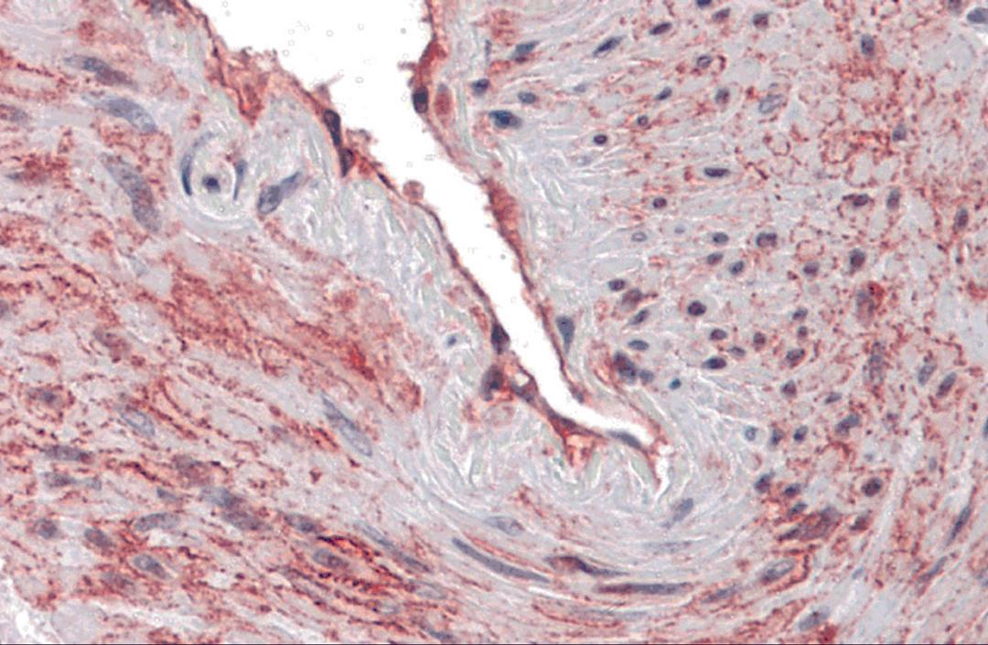 Immunohistochemistry of SCUBE3 in human blood vessel tissue with SCUBE3 antibody at 10 μg/mL.