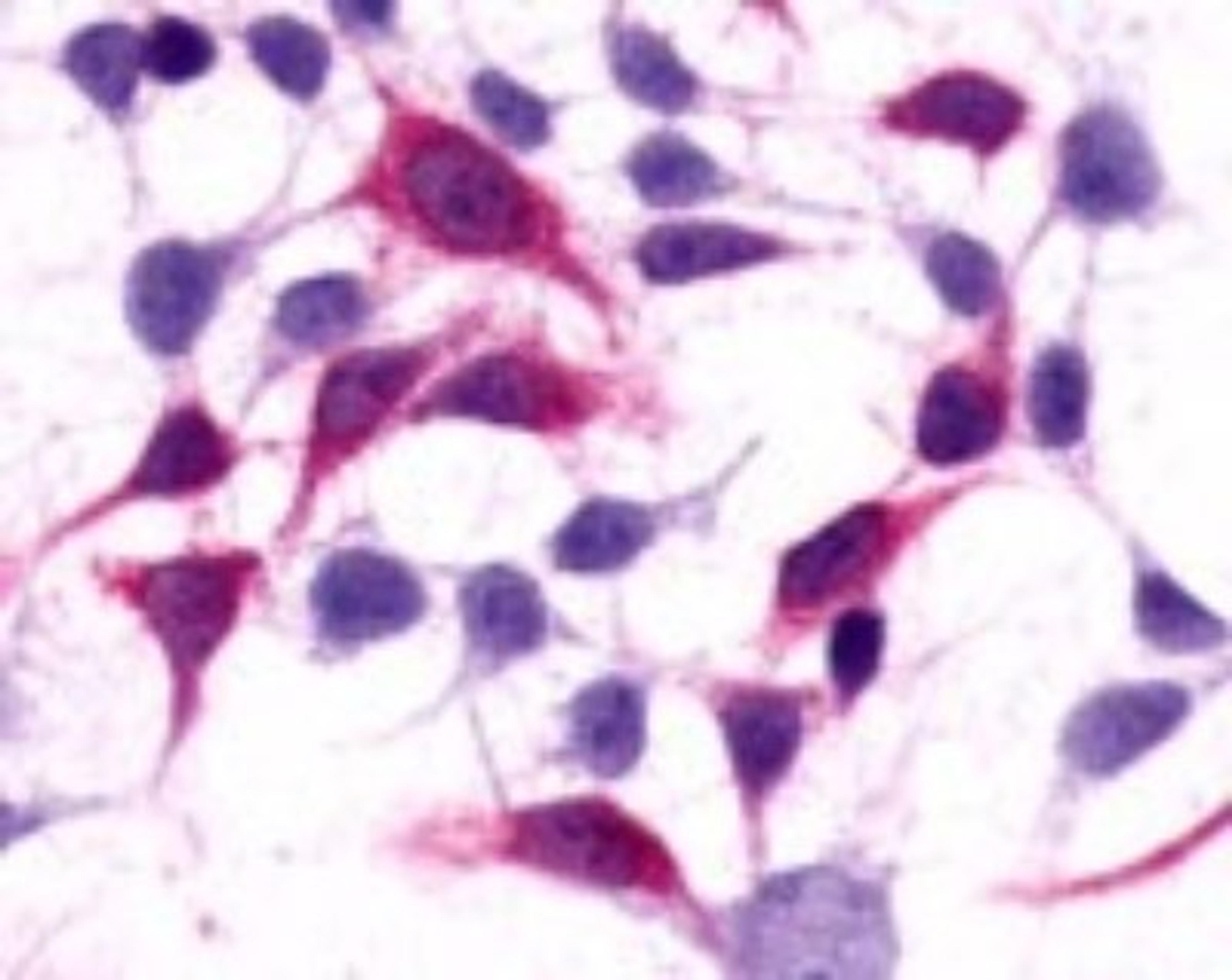 Immunohistochemistry-Paraffin: mGluR3 Antibody [NLS3208] - Analysis of anti-GRM3 / MGLUR3 antibody with HEK293 human embryonic kidney cells transfected with GRM3 / MGLUR3.