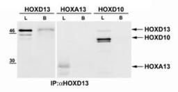 Immunoprecipitation: HOXD13 Antibody [NBP2-24889] - Analysis of HOXD13 (left) from mouse E13.5 embryonic limb tissue lysate and mouse brain tissue lysate using 5 ug of this antibody.