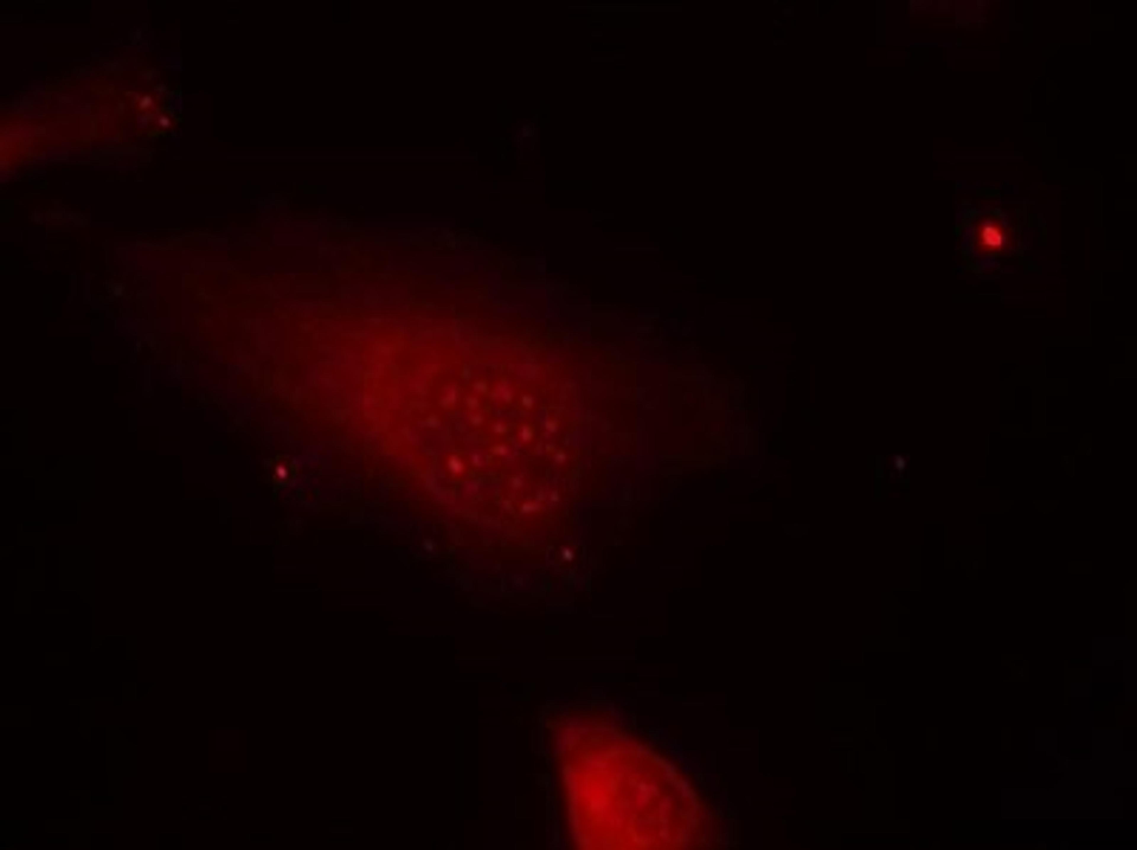 Immunocytochemistry/Immunofluorescence: FOXO1A [p Ser319] Antibody [NB100-81925] - Staining of methanol-fixed Hela cells using FKHR(Phospho-Ser319) antibody