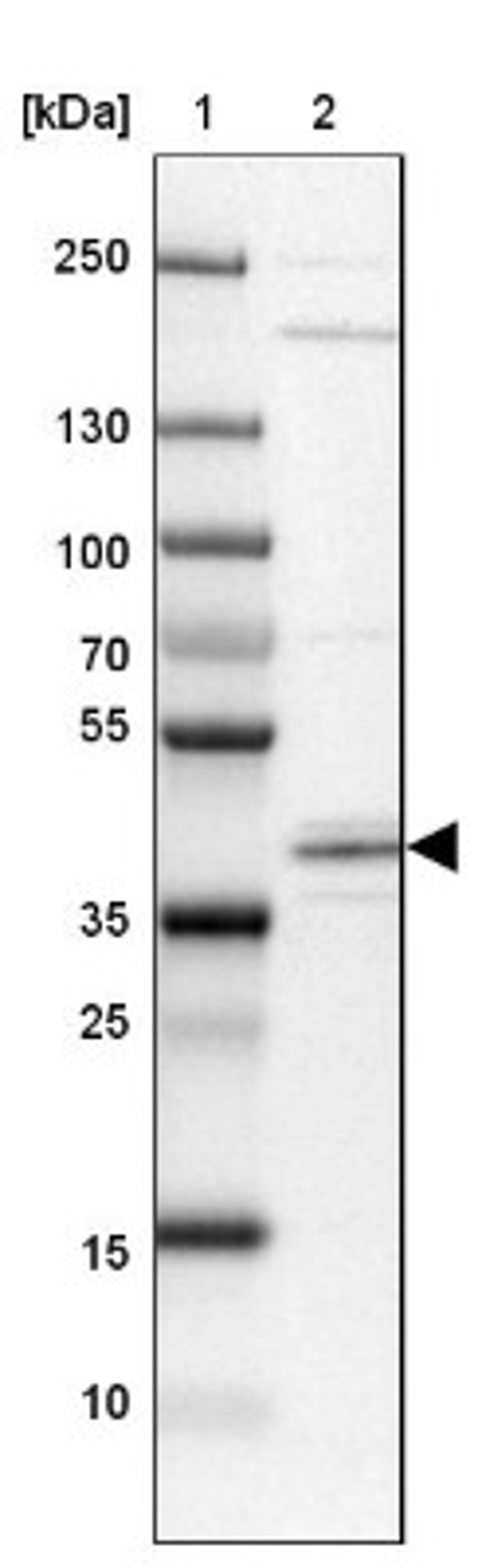 Western Blot: SCD5 Antibody [NBP1-89274] - Lane 1: Marker [kDa] 250, 130, 100, 70, 55, 35, 25, 15, 10<br/>Lane 2: MOLT-4