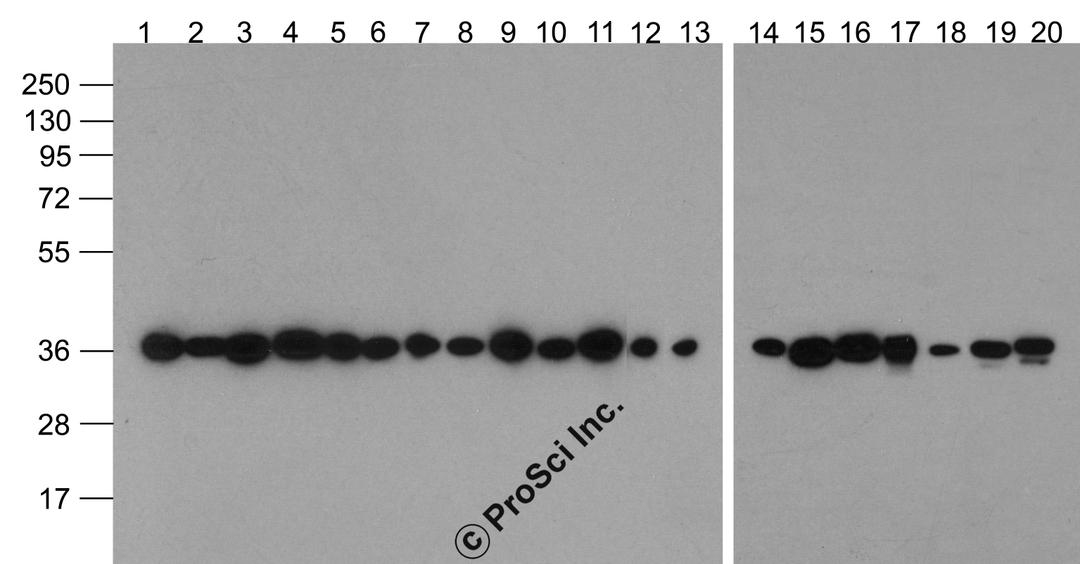Western blot analysis of GAPDH in multiple cell and tissue lysates with Biotin-GAPDH antibody at 1 μg/ml. Lanes 1-20: 293, A431, A549, Daudi, HeLa, HepG2, Jurkat, K562, MOLT, 3T3, Raji, Ramos, U937, human brain, mouse brain, rat brain, rabbit brain,