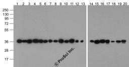 Western blot analysis of GAPDH in multiple cell and tissue lysates with Biotin-GAPDH antibody at 1 μg/ml. Lanes 1-20: 293, A431, A549, Daudi, HeLa, HepG2, Jurkat, K562, MOLT, 3T3, Raji, Ramos, U937, human brain, mouse brain, rat brain, rabbit brain,