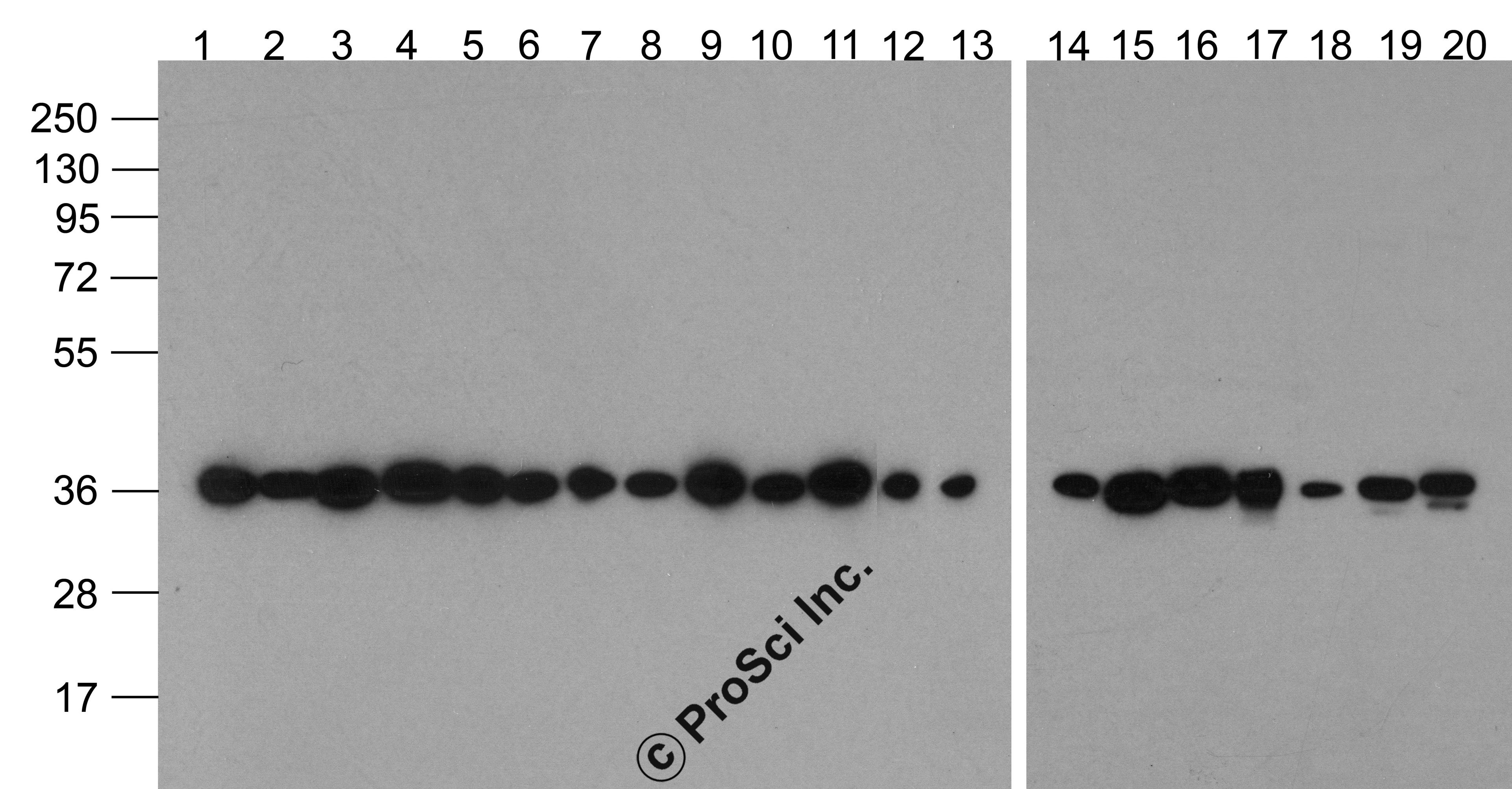 Western blot analysis of GAPDH in multiple cell and tissue lysates with Biotin-GAPDH antibody at 1 μg/ml. Lanes 1-20: 293, A431, A549, Daudi, HeLa, HepG2, Jurkat, K562, MOLT, 3T3, Raji, Ramos, U937, human brain, mouse brain, rat brain, rabbit brain,