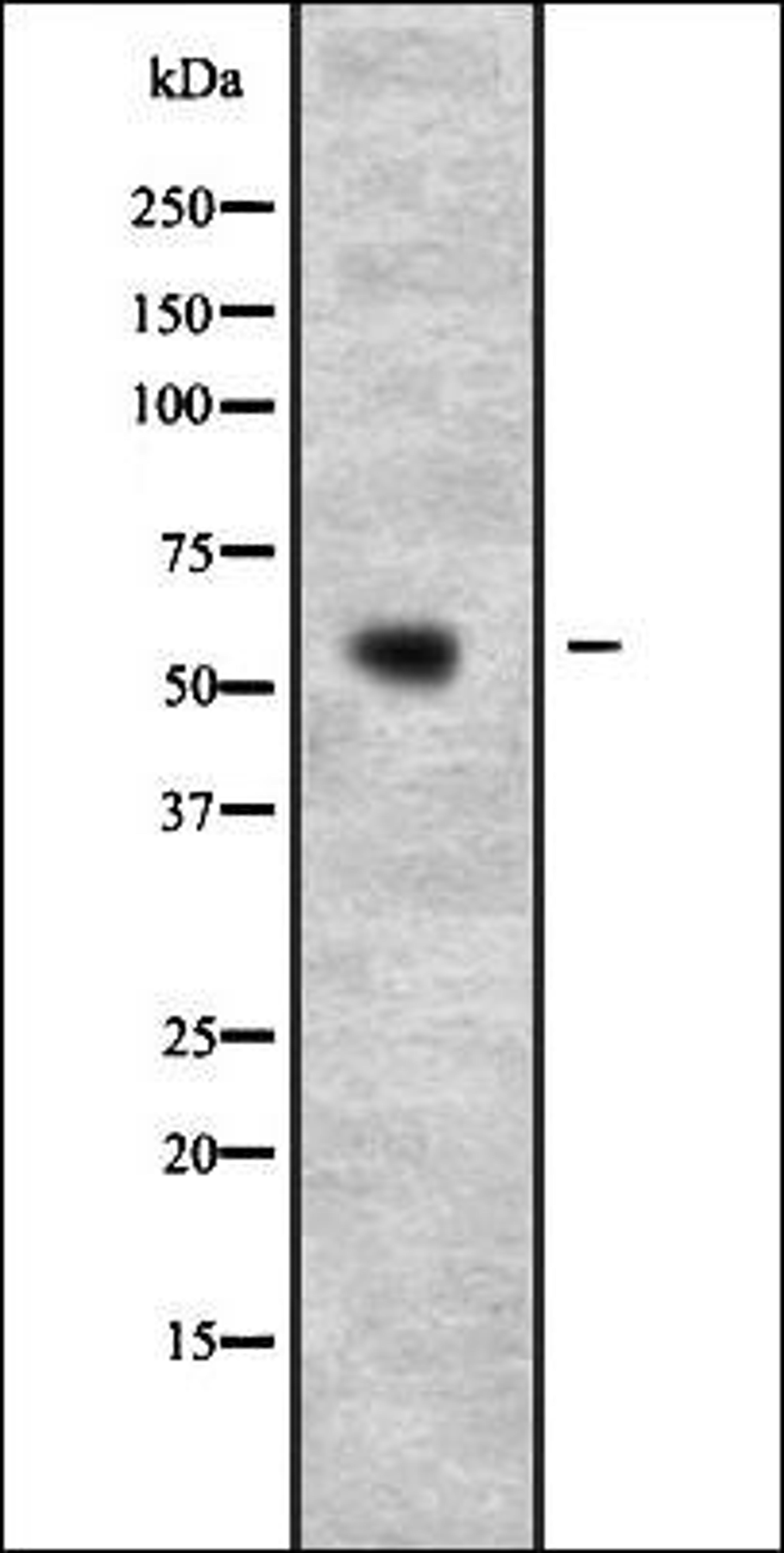 Western blot analysis of U2OS -Human osteosarcoma cell line- Whole Cell Lysate using PSPC1 antibody