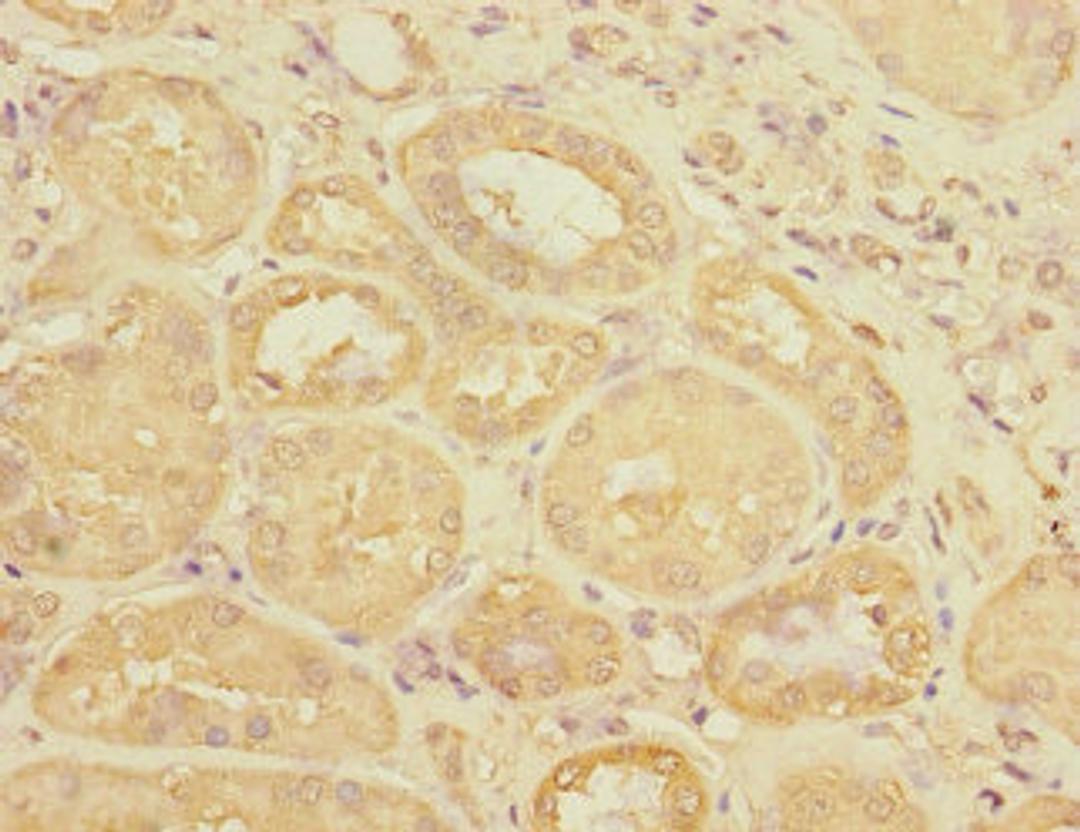 Immunohistochemistry of paraffin-embedded human kidney tissue using CSB-PA025657ESR2HU at dilution of 1:100