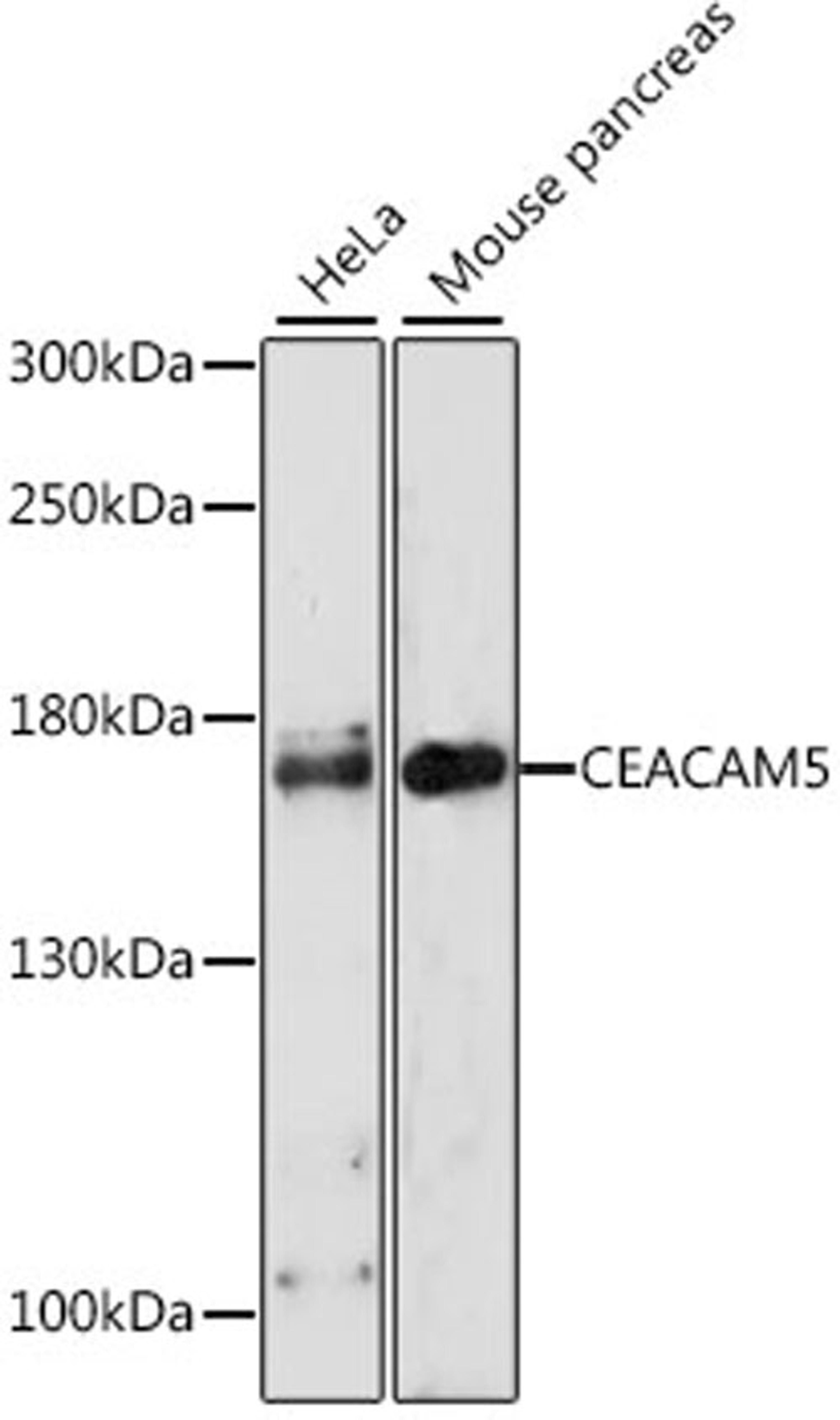 Western blot - CEACAM5 antibody (A0970)