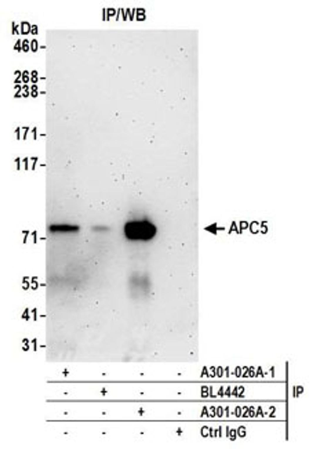 Detection of human APC5 by western blot of immunoprecipitates.