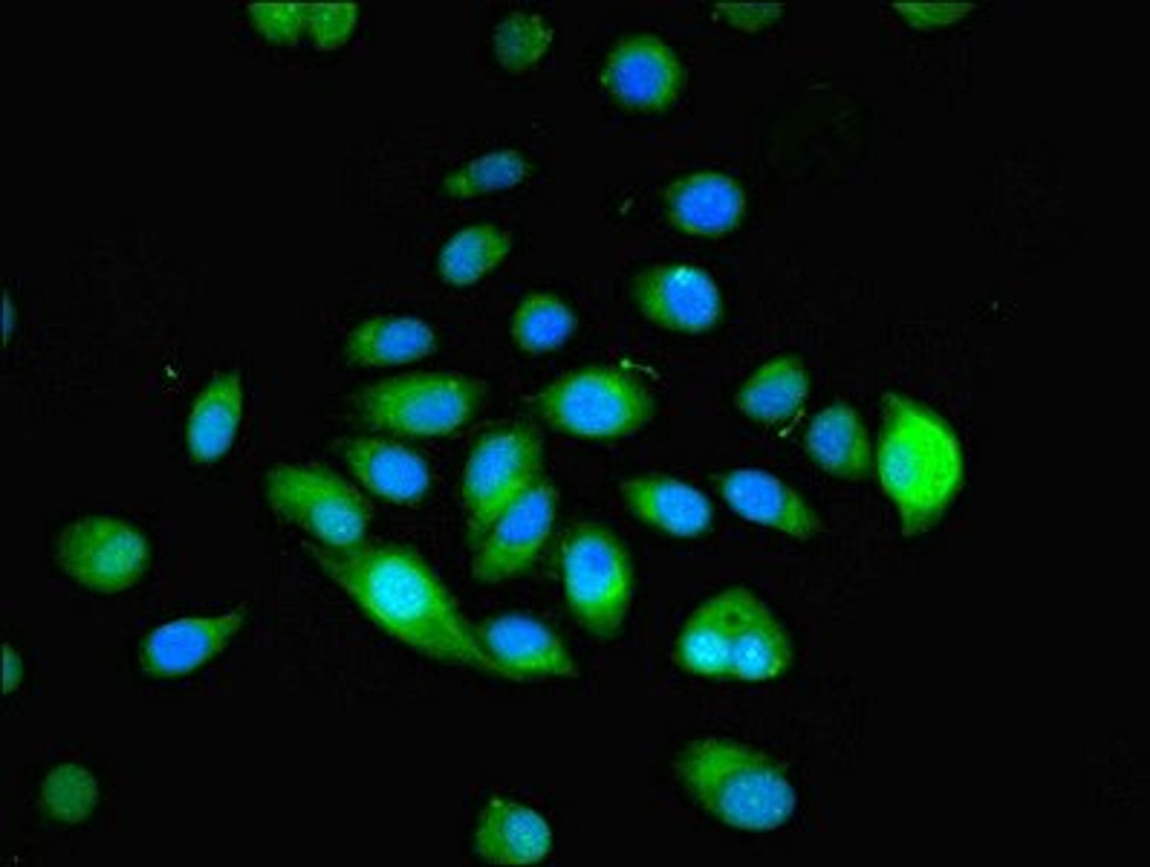 Immunofluorescence analysis of A549 cells using MYADM antibody