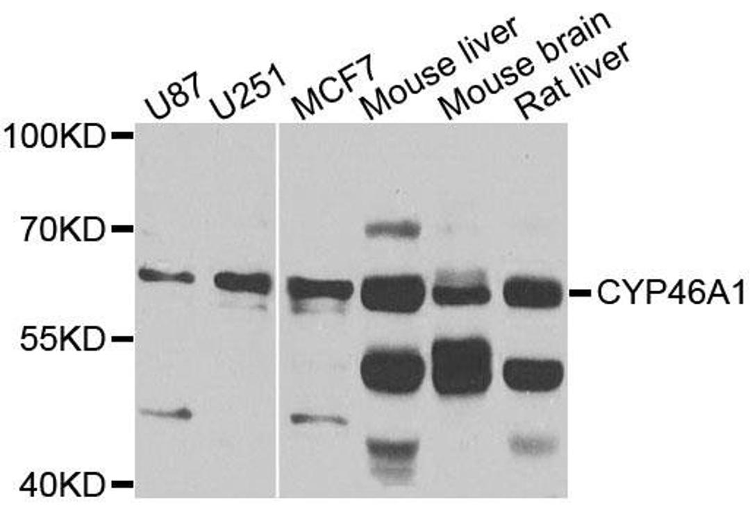 Western blot analysis of extracts of various cells using CYP46A1 antibody