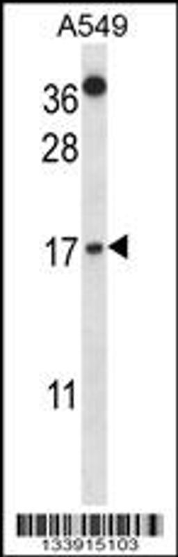 Western blot analysis in A549 cell line lysates (35ug/lane).