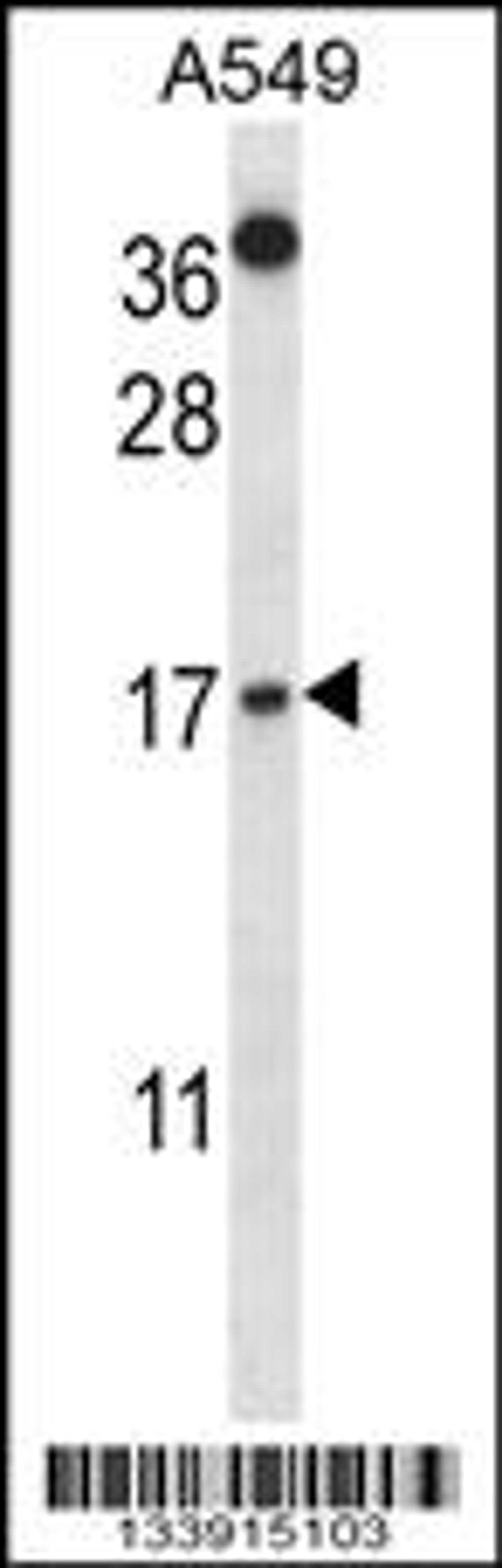 Western blot analysis in A549 cell line lysates (35ug/lane).