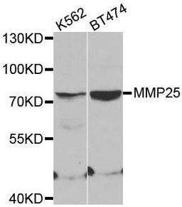 Western blot analysis of extracts of various cell lines using MMP25 antibody