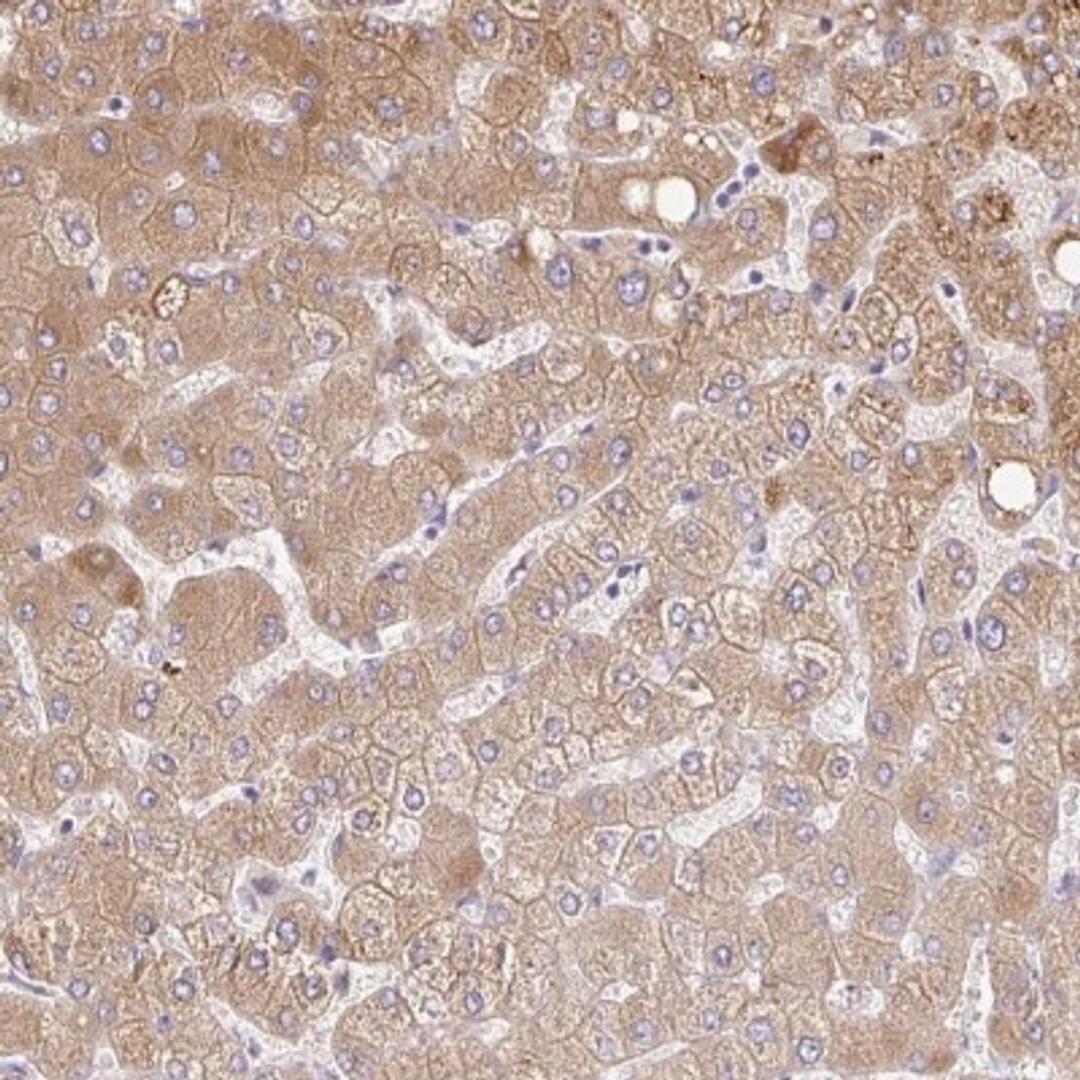 Immunohistochemistry: C14orf178 Antibody [NBP2-32364] - Immunohistochemical staining of human liver shows moderate cytoplasmic positivity in hepatocytes.