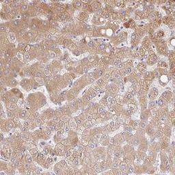 Immunohistochemistry: C14orf178 Antibody [NBP2-32364] - Immunohistochemical staining of human liver shows moderate cytoplasmic positivity in hepatocytes.