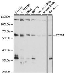 Western blot - CCT6A antibody (A3589)