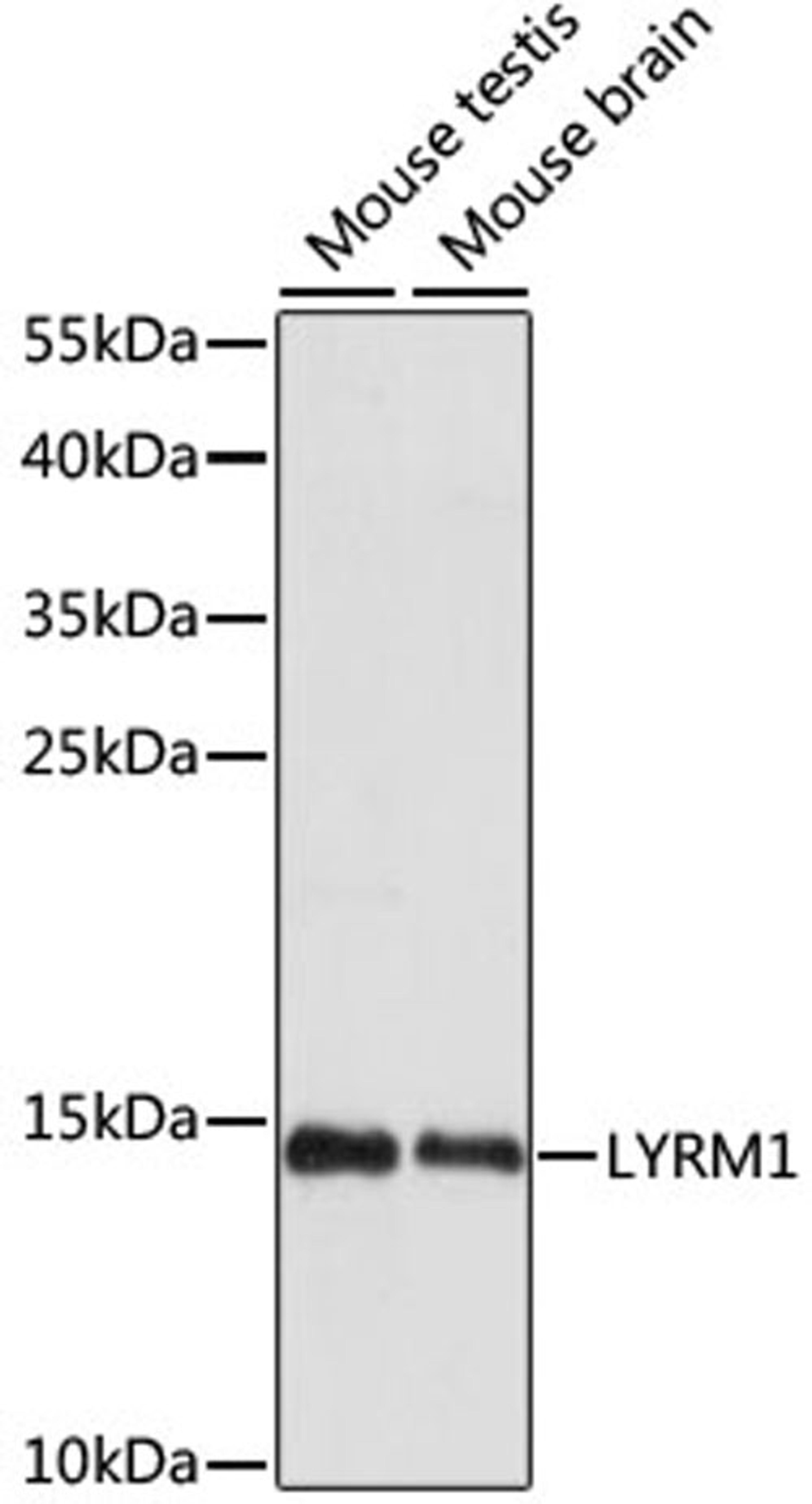 Western blot - LYRM1 antibody (A15483)