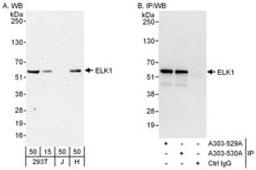 Detection of human ELK1 by western blot and immunoprecipitation.