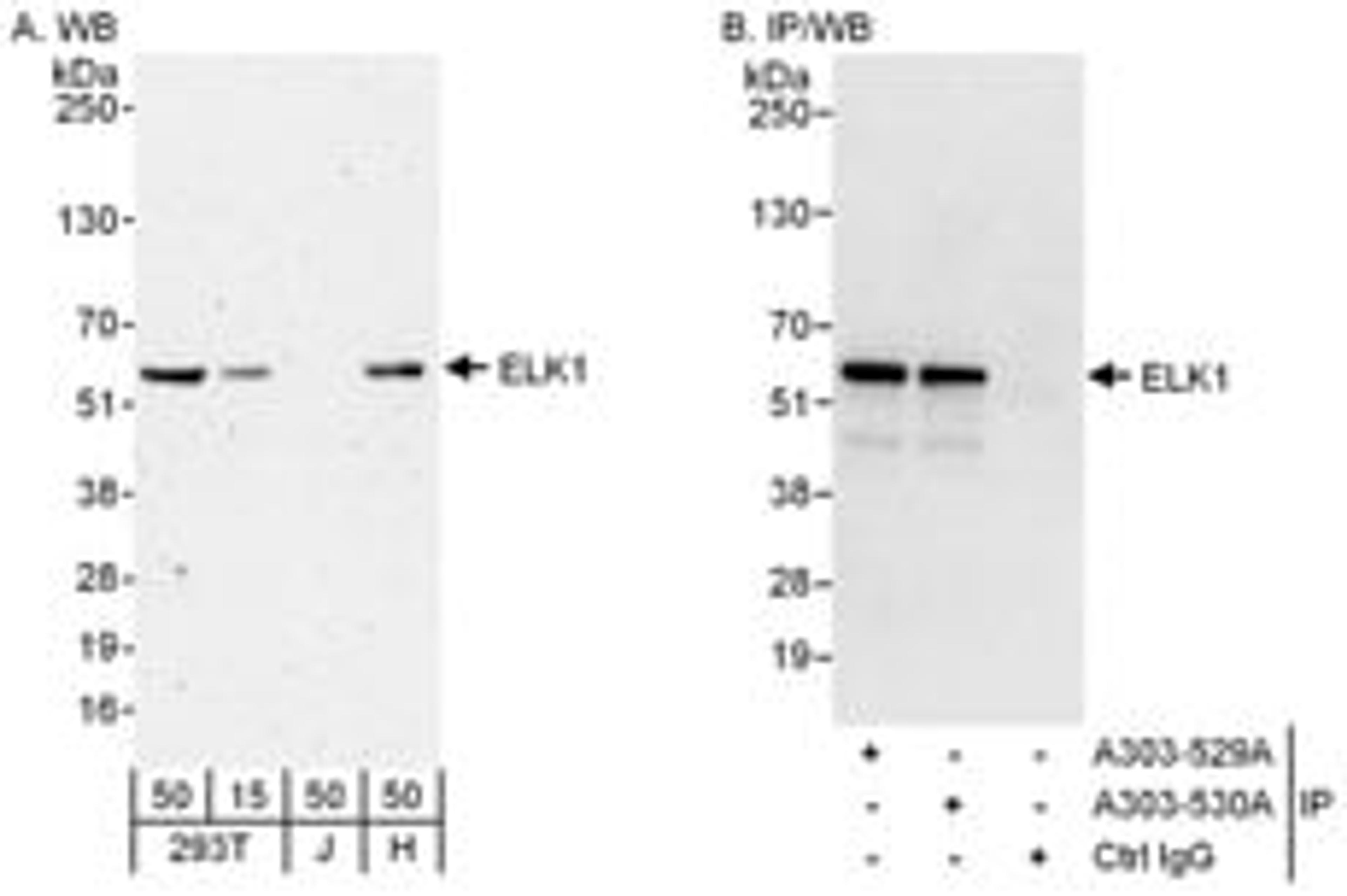 Detection of human ELK1 by western blot and immunoprecipitation.